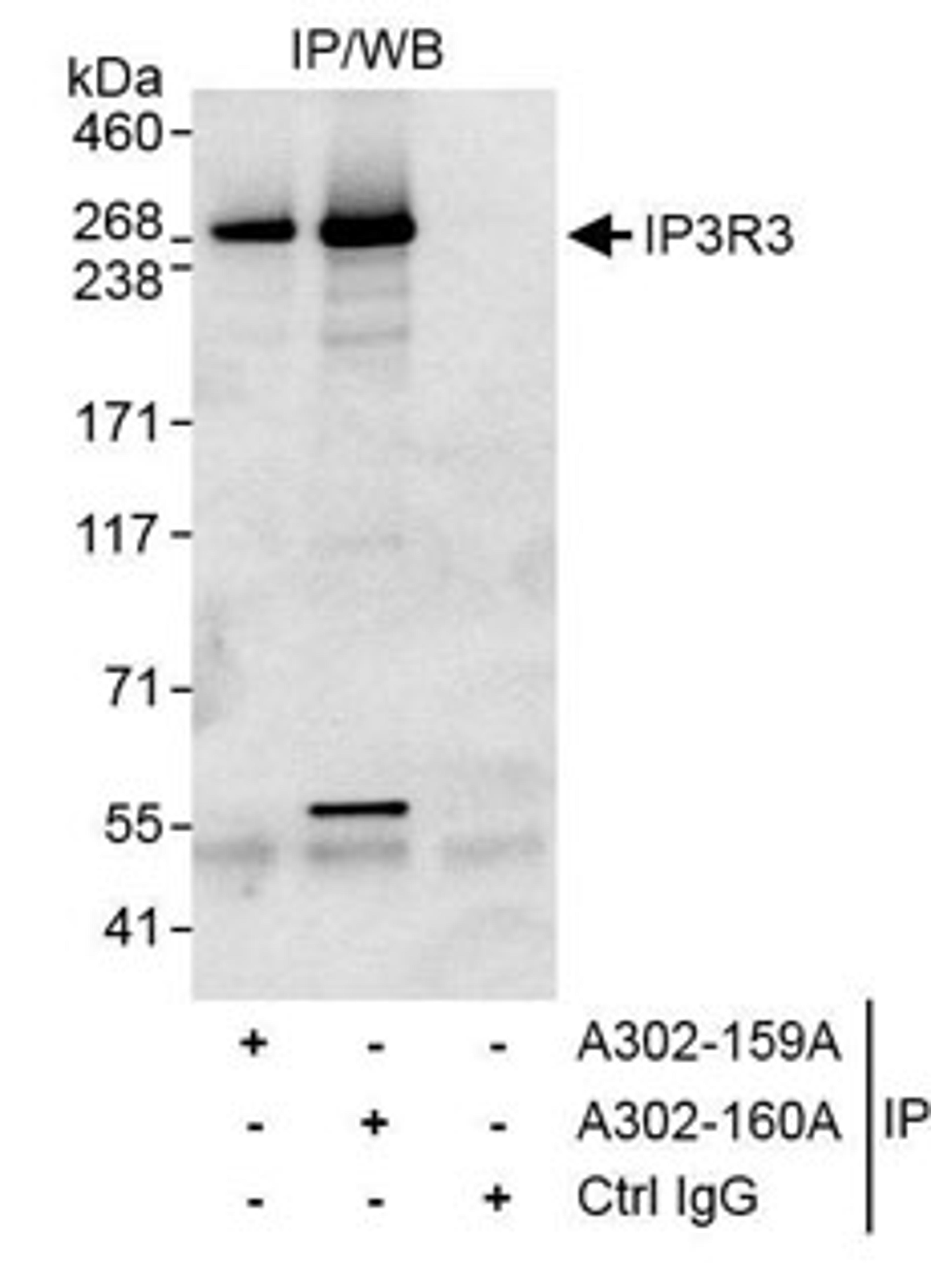 Detection of human IP3R3 by western blot of immunoprecipitates.