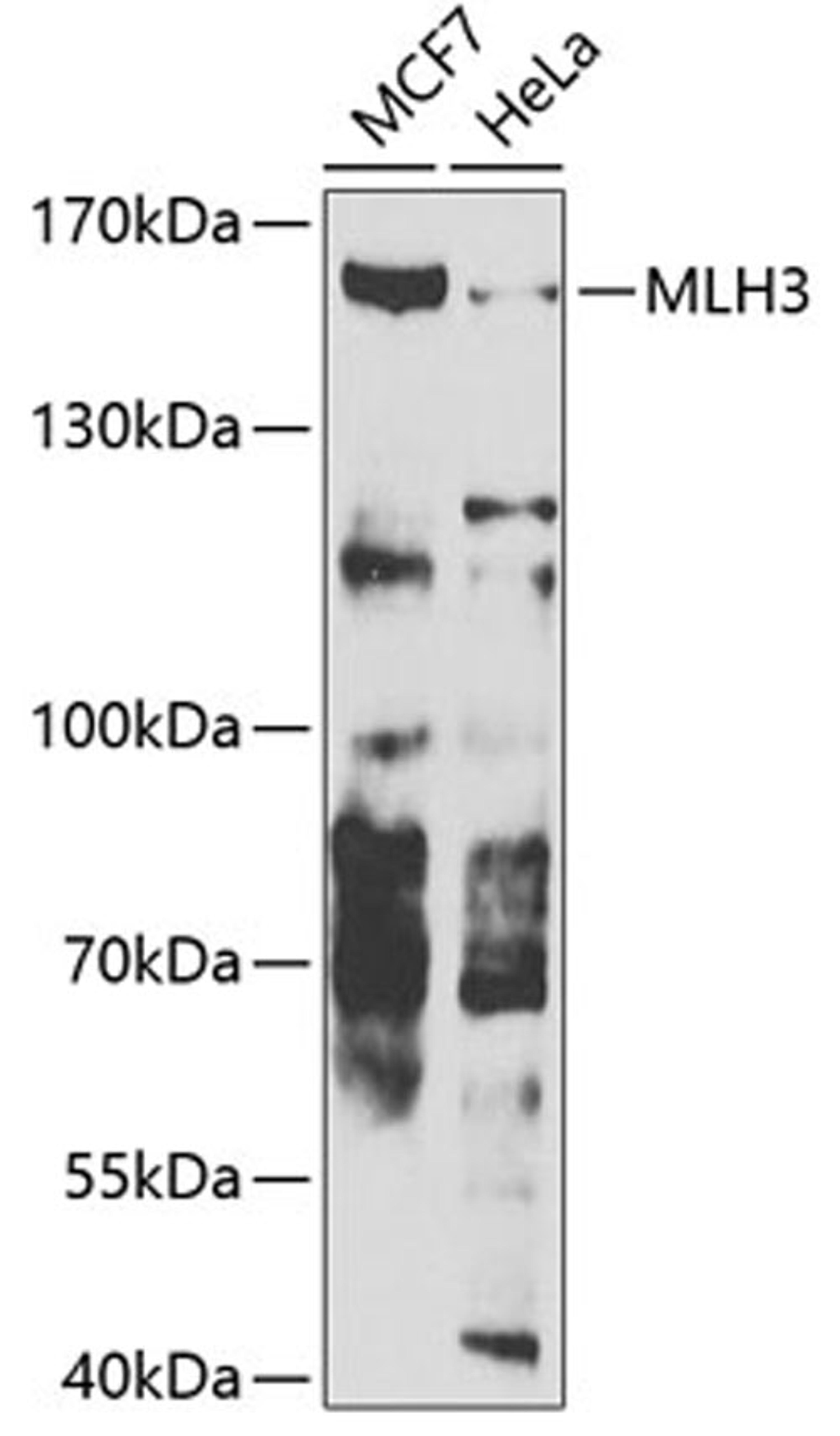 Western blot - MLH3 antibody (A7796)