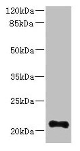 Western blot. All lanes: TTC9C antibody at 12µg/ml + THP-1 whole cell lysate. Secondary. Goat polyclonal to rabbit IgG at 1/10000 dilution. Predicted band size: 21, 25 kDa. Observed band size: 21 kDa
