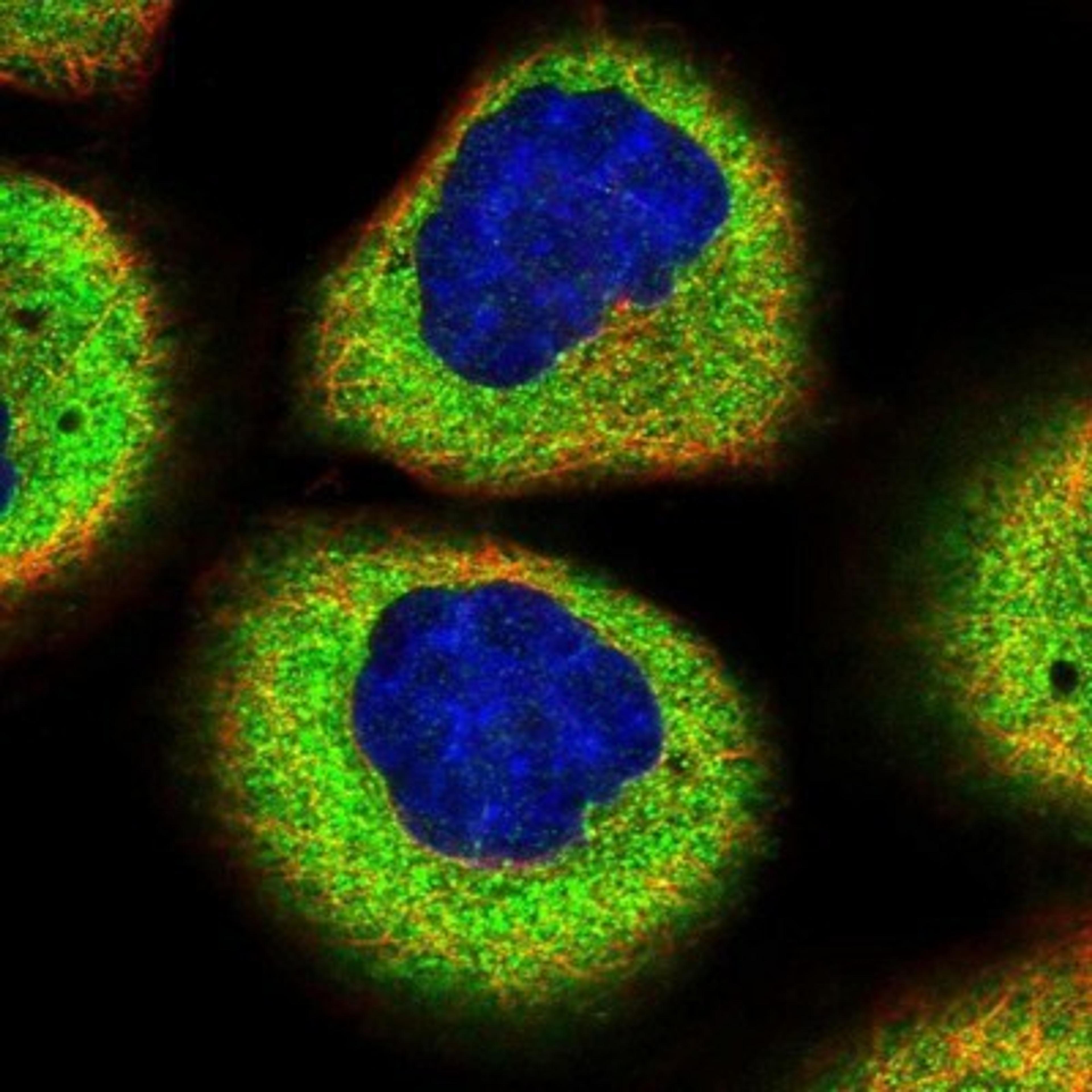 Immunocytochemistry/Immunofluorescence: SMG7 Antibody [NBP1-88486] - Staining of human cell line A-431 shows positivity in cytoplasm.