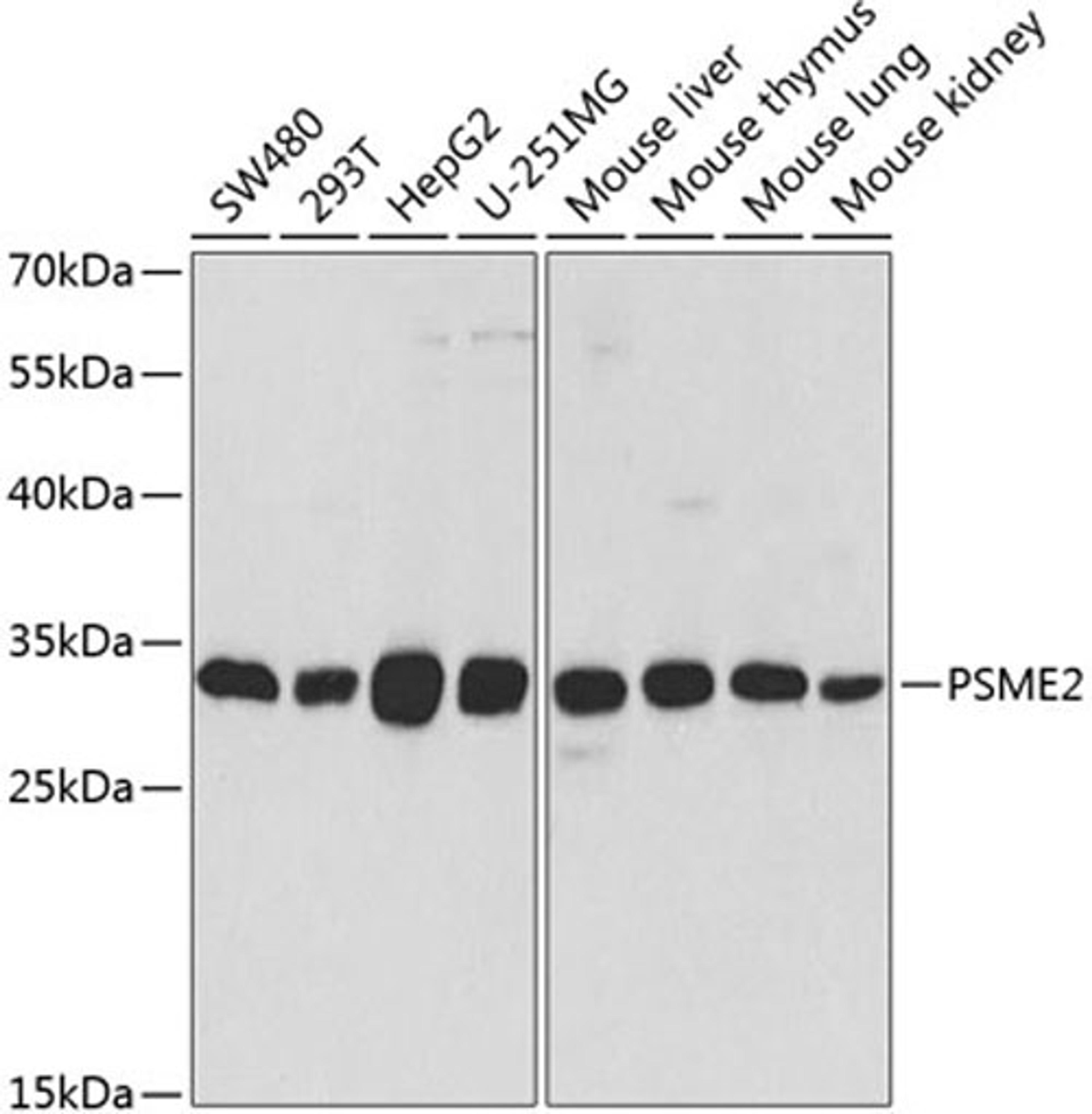 Western blot - PSME2 antibody (A5562)