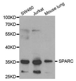 Western blot analysis of extracts of various cell lines using SPARC antibody