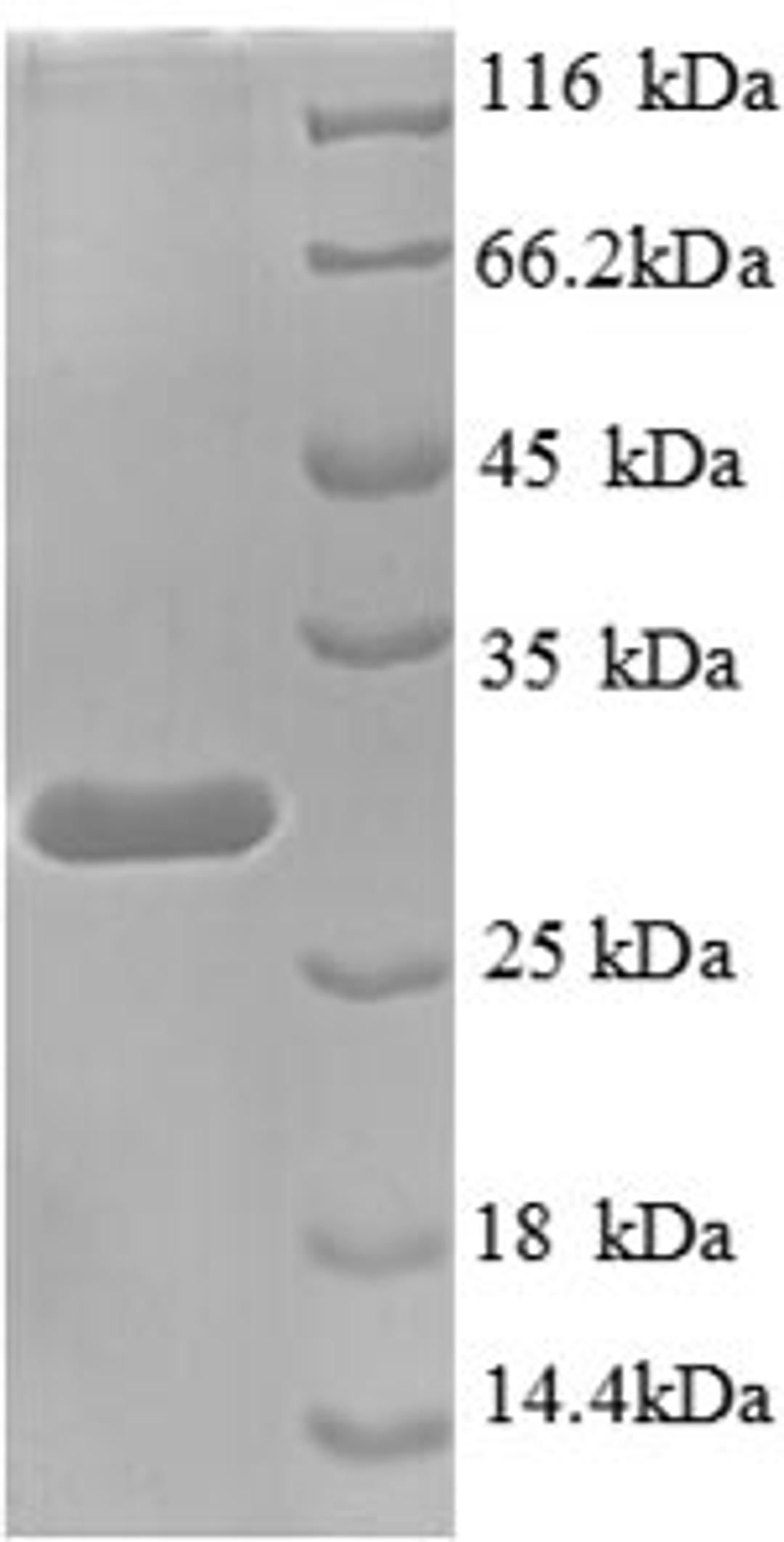 (Tris-Glycine gel) Discontinuous SDS-PAGE (reduced) with 5% enrichment gel and 15% separation gel.