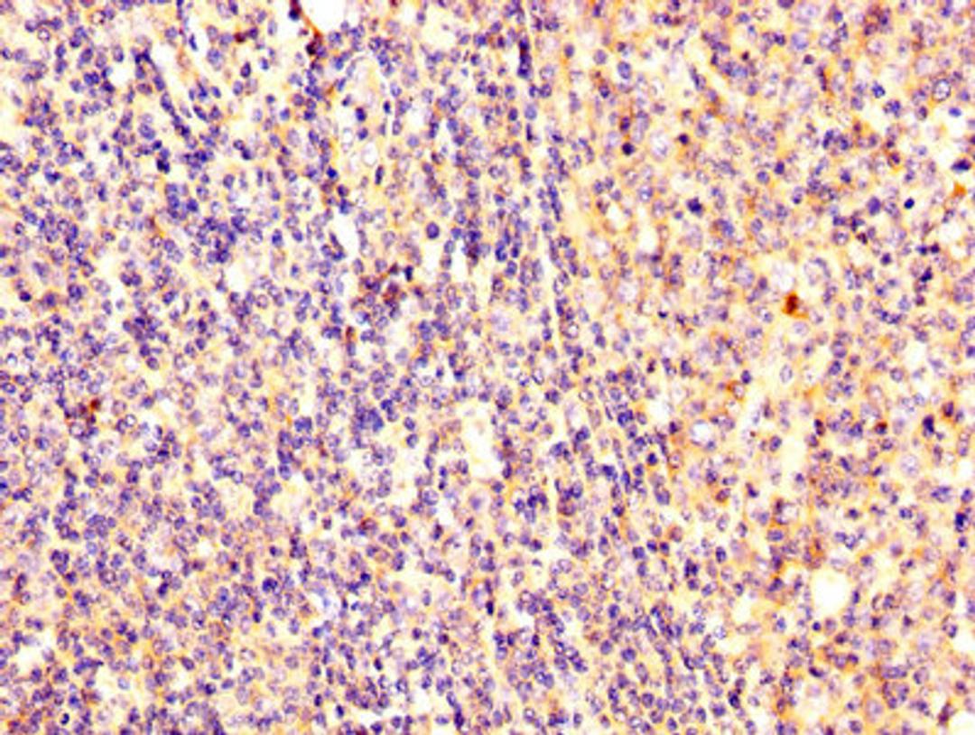 IHC image of CSB-PA02159A0Rb diluted at 1:300 and staining in paraffin-embedded human tonsil tissue performed on a Leica BondTM system. After dewaxing and hydration, antigen retrieval was mediated by high pressure in a citrate buffer (pH 6.0). Section was blocked with 10% normal goat serum 30min at RT. Then primary antibody (1% BSA) was incubated at 4°C overnight. The primary is detected by a biotinylated secondary antibody and visualized using an HRP conjugated SP system.