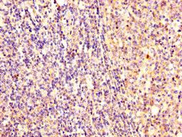IHC image of CSB-PA02159A0Rb diluted at 1:300 and staining in paraffin-embedded human tonsil tissue performed on a Leica BondTM system. After dewaxing and hydration, antigen retrieval was mediated by high pressure in a citrate buffer (pH 6.0). Section was blocked with 10% normal goat serum 30min at RT. Then primary antibody (1% BSA) was incubated at 4°C overnight. The primary is detected by a biotinylated secondary antibody and visualized using an HRP conjugated SP system.