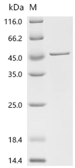 (Tris-Glycine gel) Discontinuous SDS-PAGE (reduced) with 5% enrichment gel and 15% separation gel.