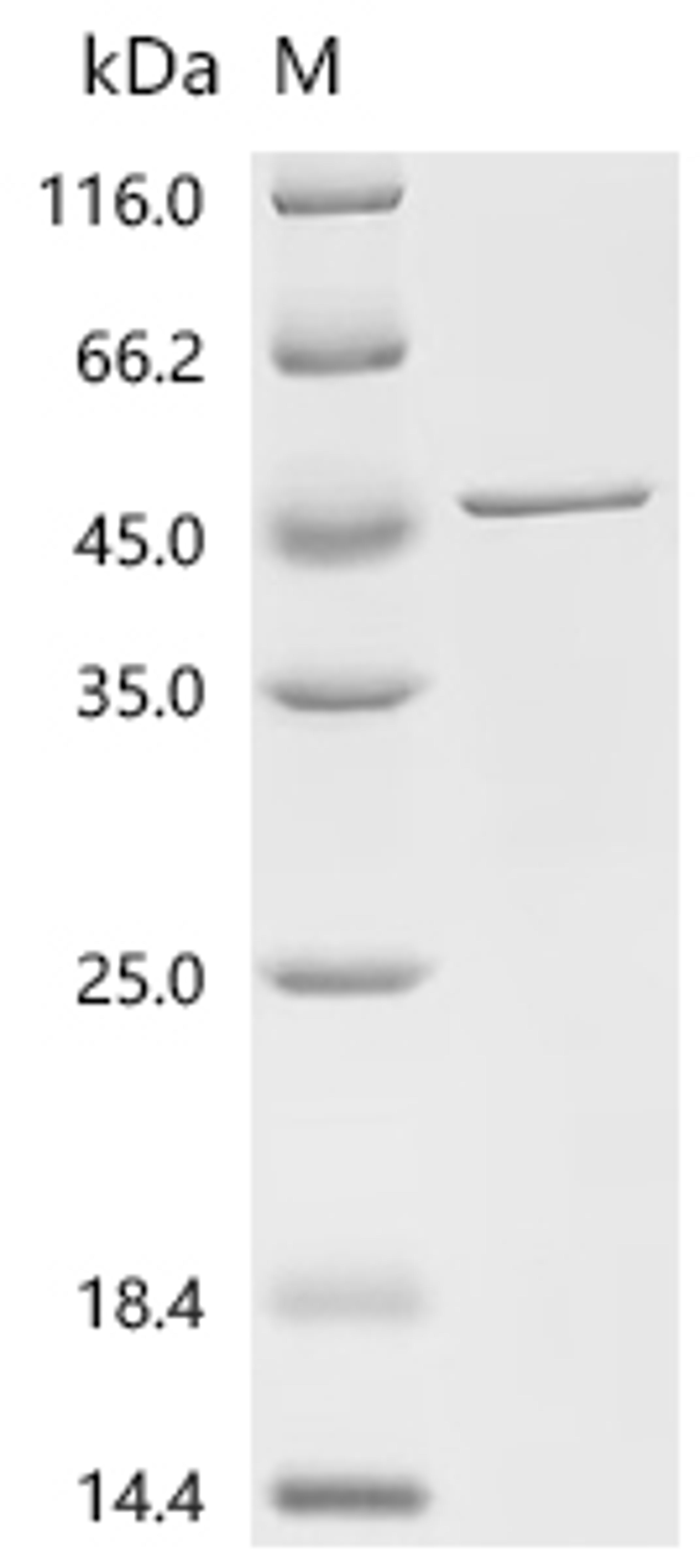 (Tris-Glycine gel) Discontinuous SDS-PAGE (reduced) with 5% enrichment gel and 15% separation gel.