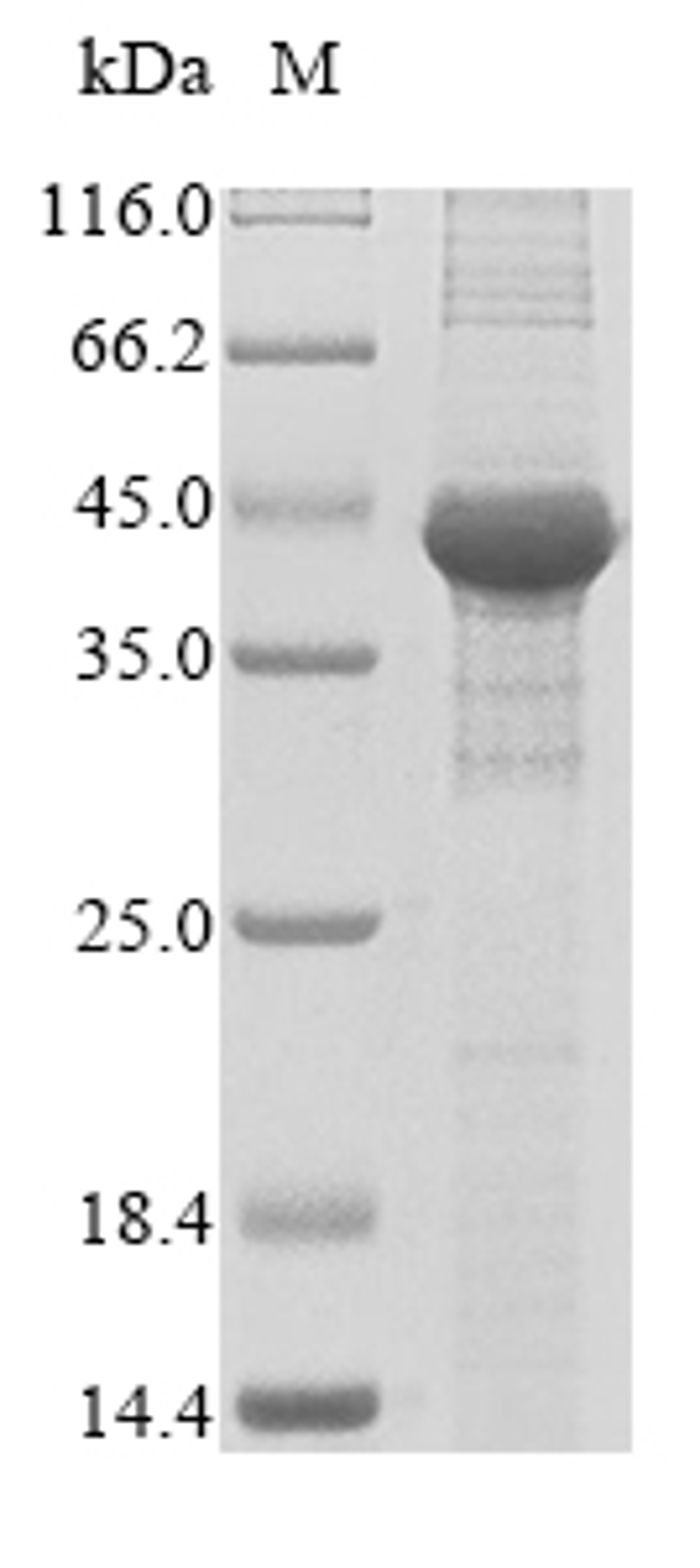 (Tris-Glycine gel) Discontinuous SDS-PAGE (reduced) with 5% enrichment gel and 15% separation gel.