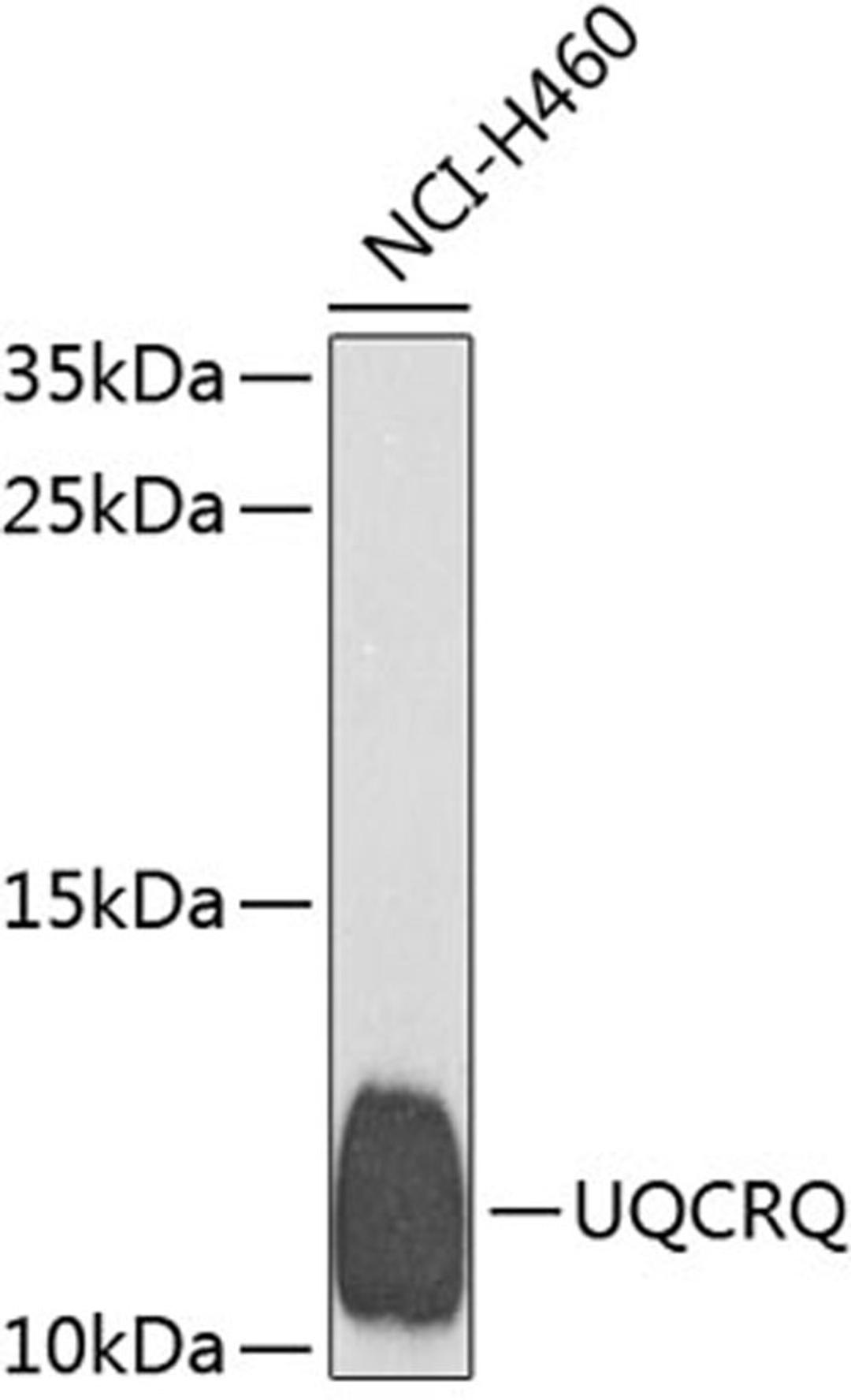 Western blot - UQCRQ antibody (A9872)