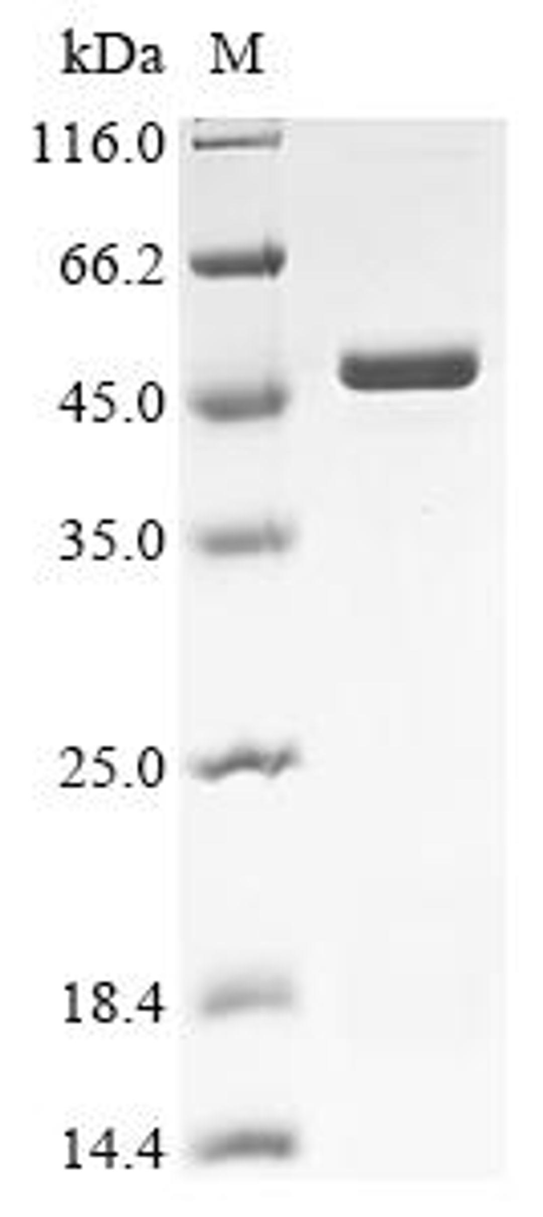(Tris-Glycine gel) Discontinuous SDS-PAGE (reduced) with 5% enrichment gel and 15% separation gel.
