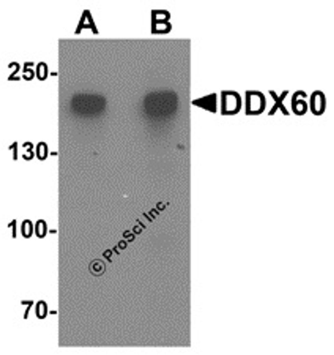 Western blot analysis of DDX60 in A20 cell lysate with DDX60 antibody at (A) 1 and (B) 2 μg/mL.