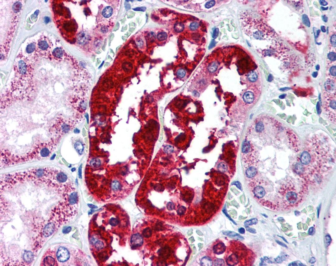 Staining of formalin fixed, paraffin embedded human kidney with Rabbit anti Human ATG5 (AHP2160)