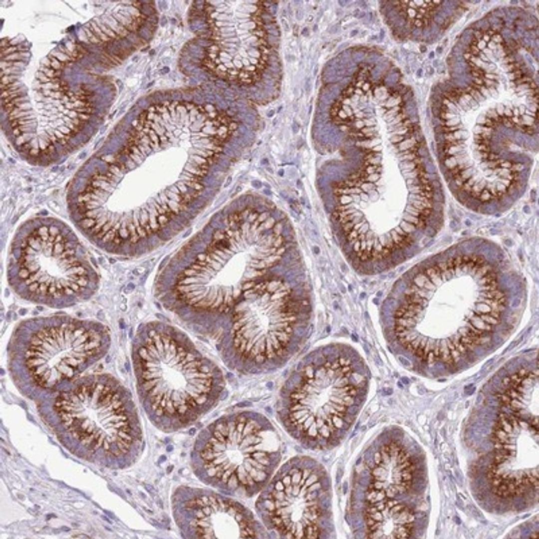 Immunohistochemistry-Paraffin: CCDC63 Antibody [NBP2-14454] - Staining of human stomach, upper shows strong cytoplasmic positivity in glandular cells.