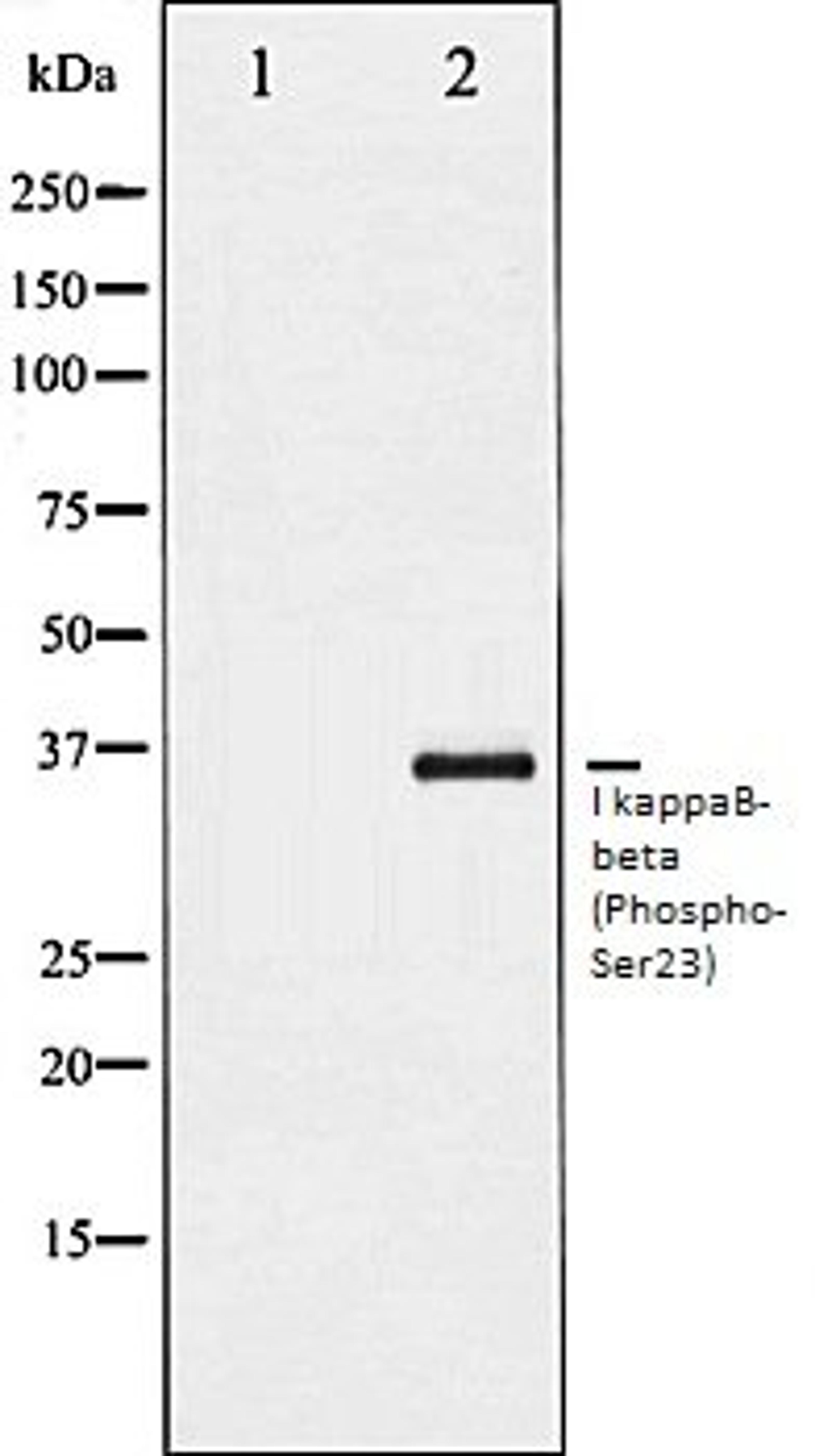 Western blot analysis of HeLa whole cell lysates using I kappaB- beta (Phospho-Ser23) antibody, The lane on the left is treated with the antigen-specific peptide.