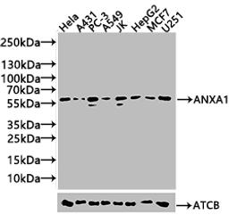 Western blot. All lanes: Annexin A11 antibody at 14ug/ml + U251 whole cell lysate. Secondary. Goat polyclonal to rabbit IgG at 1/10000 dilution. Predicted band size: 55, 52 kDa. Observed band size: 52 kDa. 