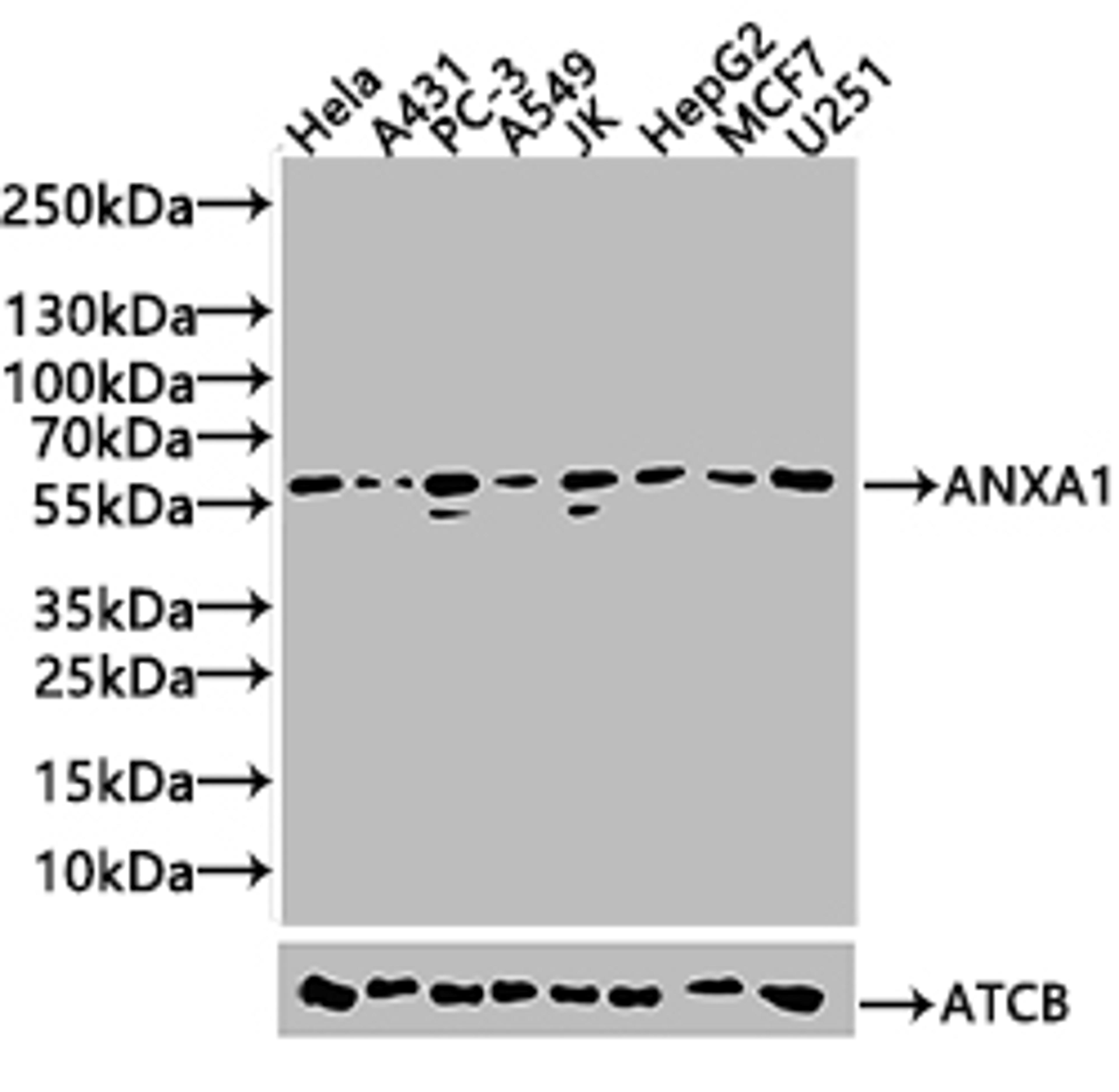 Western blot. All lanes: Annexin A11 antibody at 14ug/ml + U251 whole cell lysate. Secondary. Goat polyclonal to rabbit IgG at 1/10000 dilution. Predicted band size: 55, 52 kDa. Observed band size: 52 kDa. 