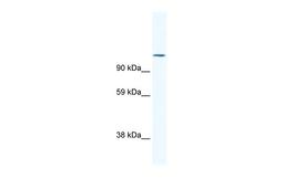 Antibody used in WB on Mouse SP2/0 at 1.25 ug/ml.