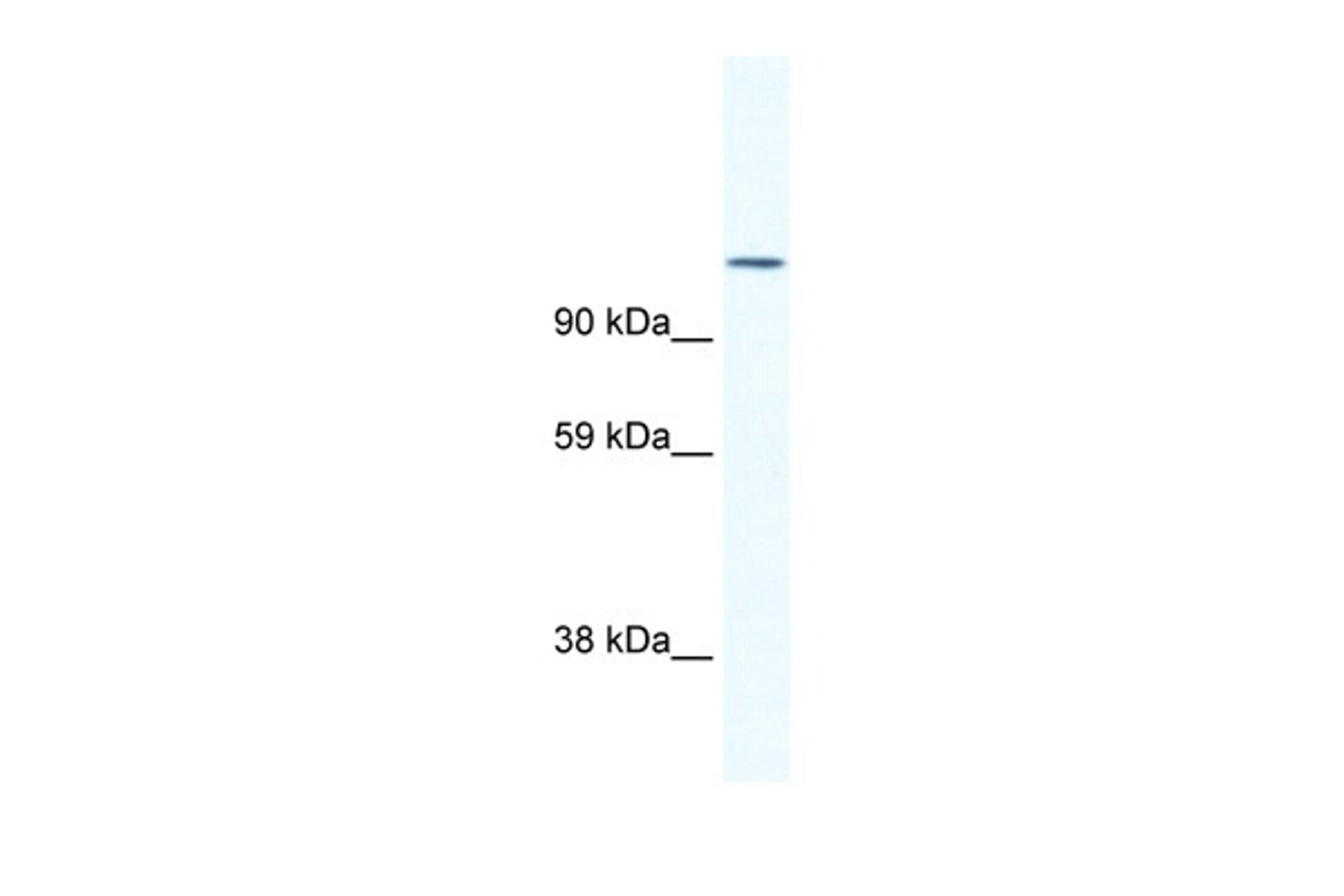 Antibody used in WB on Mouse SP2/0 at 1.25 ug/ml.