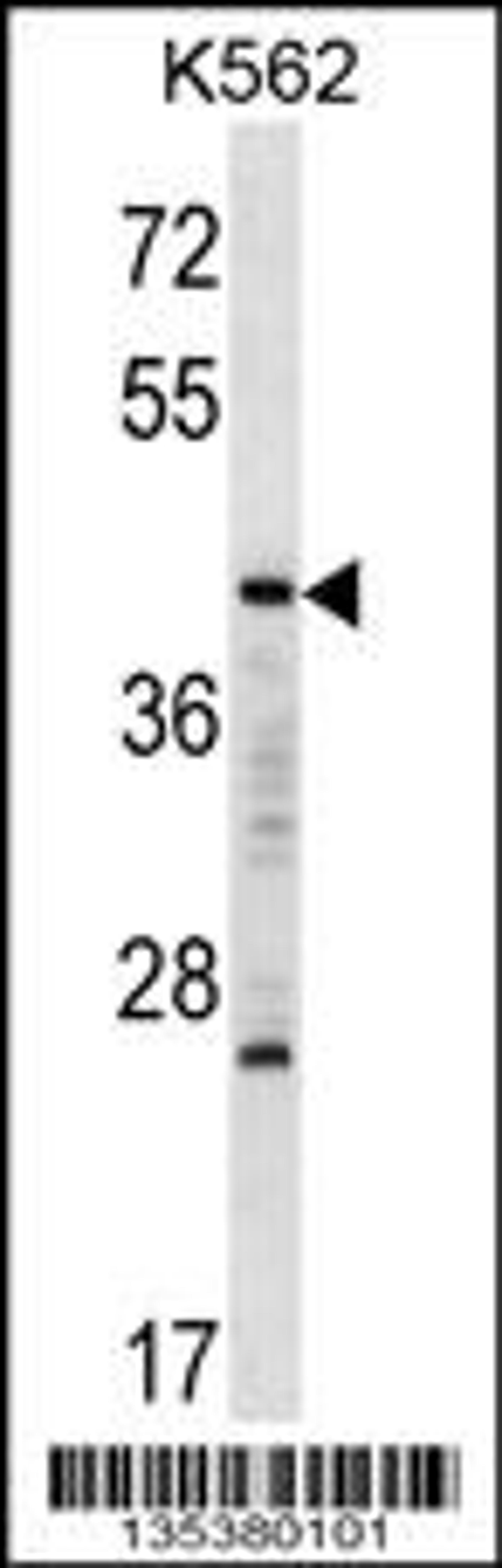 Western blot analysis in K562 cell line lysates (35ug/lane).