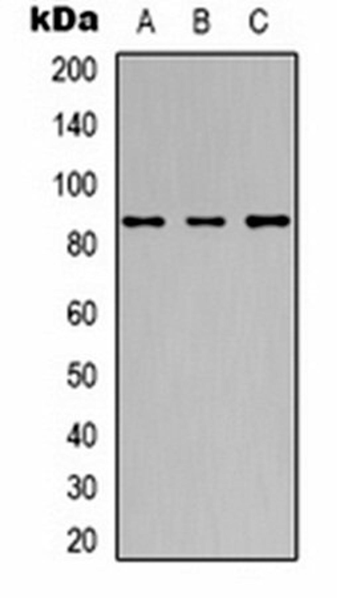 Western blot analysis of Hela (Lane 1), Jurkat (Lane 2), HepG2 (Lane 3) whole cell lysates using 42644 antibody