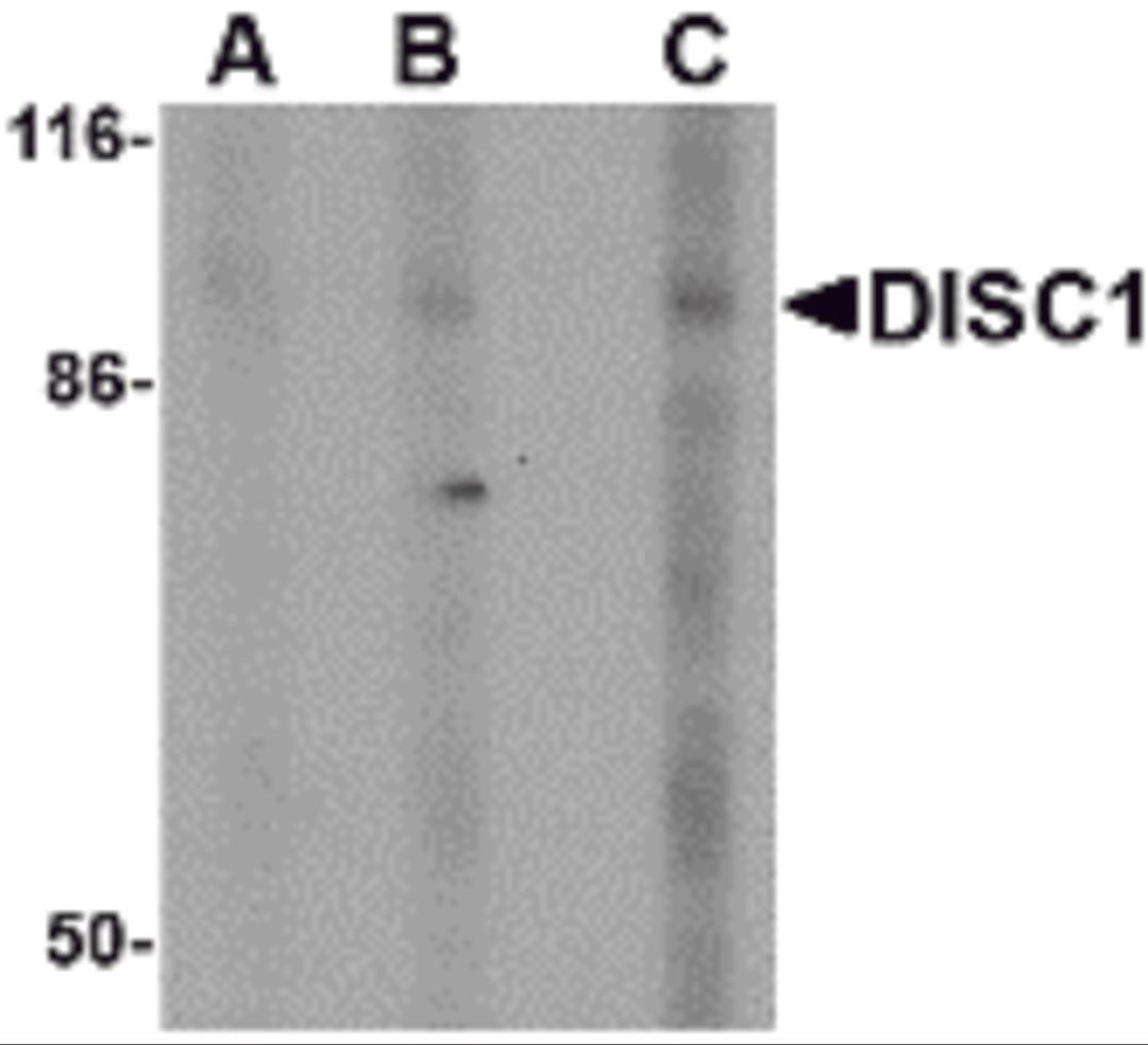 Western blot analysis of DISC1 in SK-N-SH cell lysate with DISC1 antibody at (A) 0.5, (B) 1 and (C) 2 &#956;g/mL.