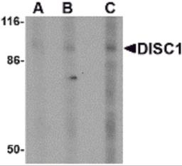 Western blot analysis of DISC1 in SK-N-SH cell lysate with DISC1 antibody at (A) 0.5, (B) 1 and (C) 2 μg/mL.