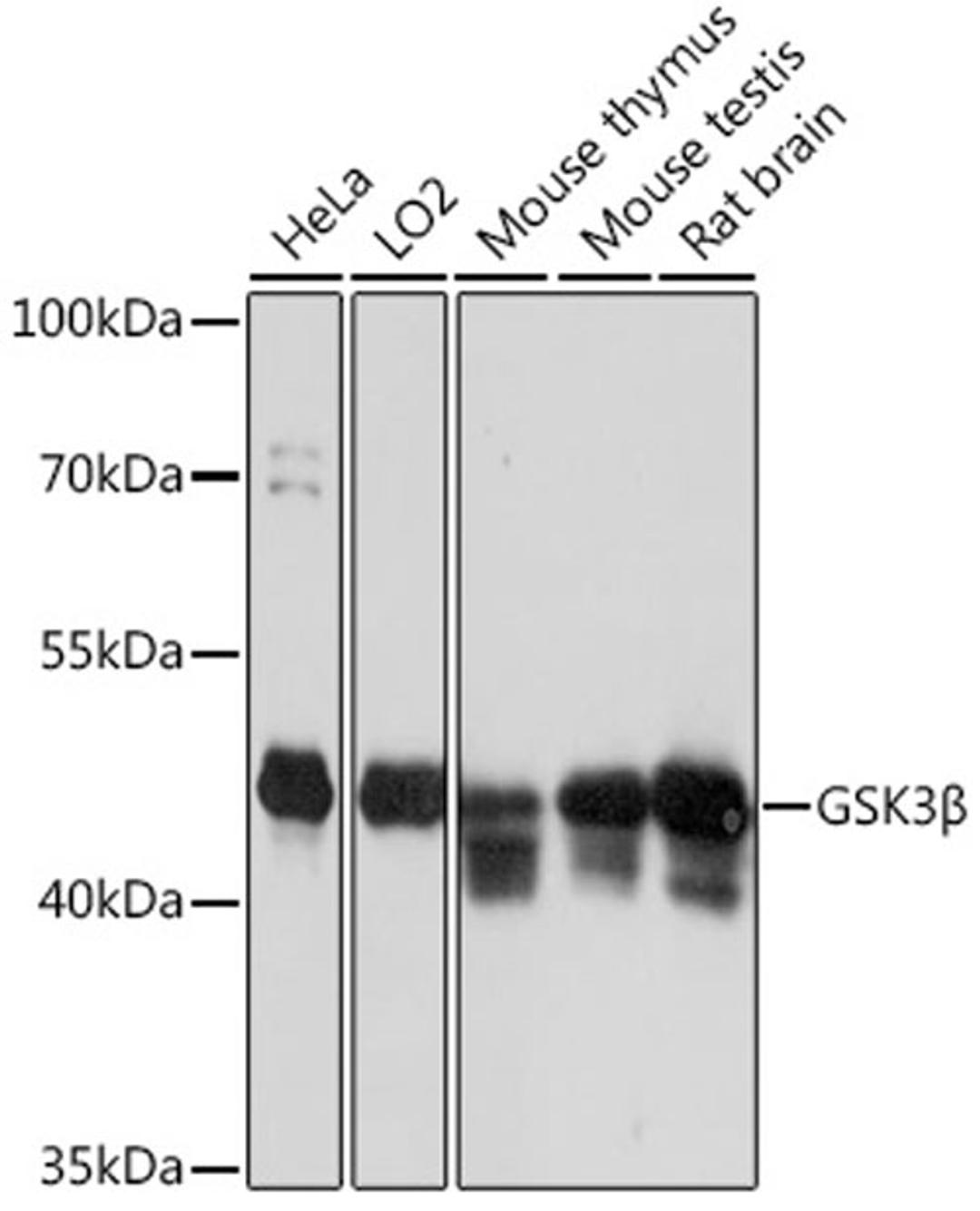 Western blot - GSK3ß antibody (A16868)