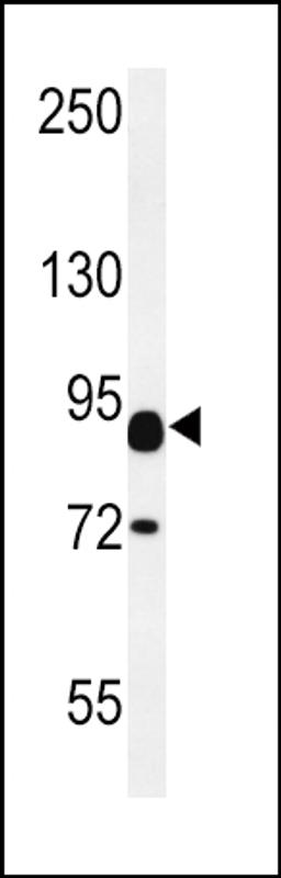 Western blot analysis in mouse heart tissue lysates (15ug/lane).This demonstrates the detected CNTN2 protein (arrow).