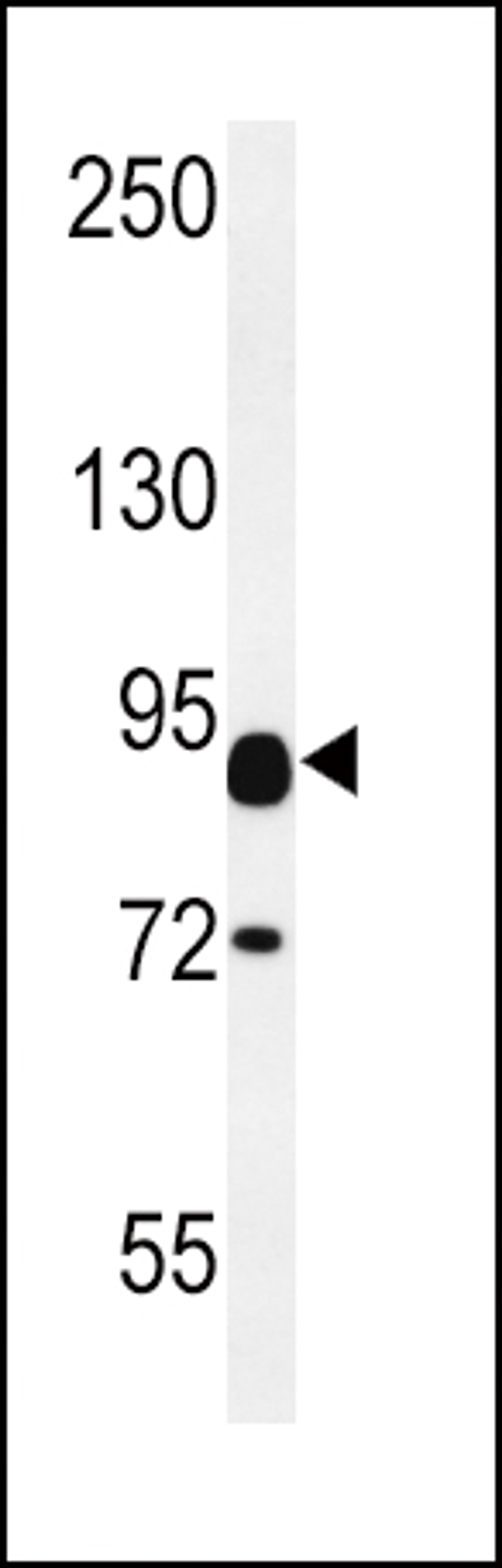 Western blot analysis in mouse heart tissue lysates (15ug/lane).This demonstrates the detected CNTN2 protein (arrow).