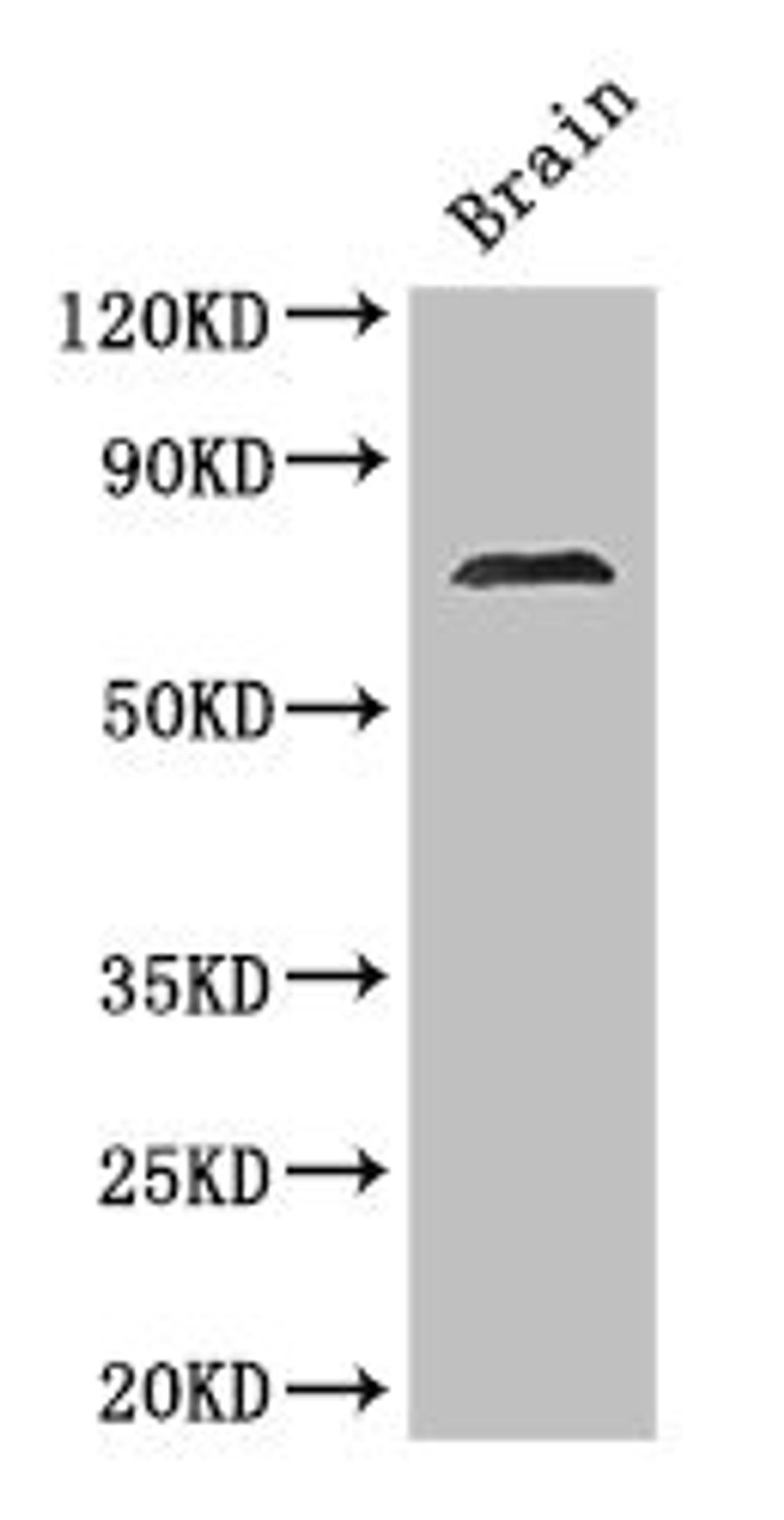 Western Blot. Positive WB detected in: Mouse brain tissue. All lanes: MAK antibody at 2.8ug/ml. Secondary. Goat polyclonal to rabbit IgG at 1/50000 dilution. Predicted band size: 71, 74, 67 kDa. Observed band size: 71 kDa.