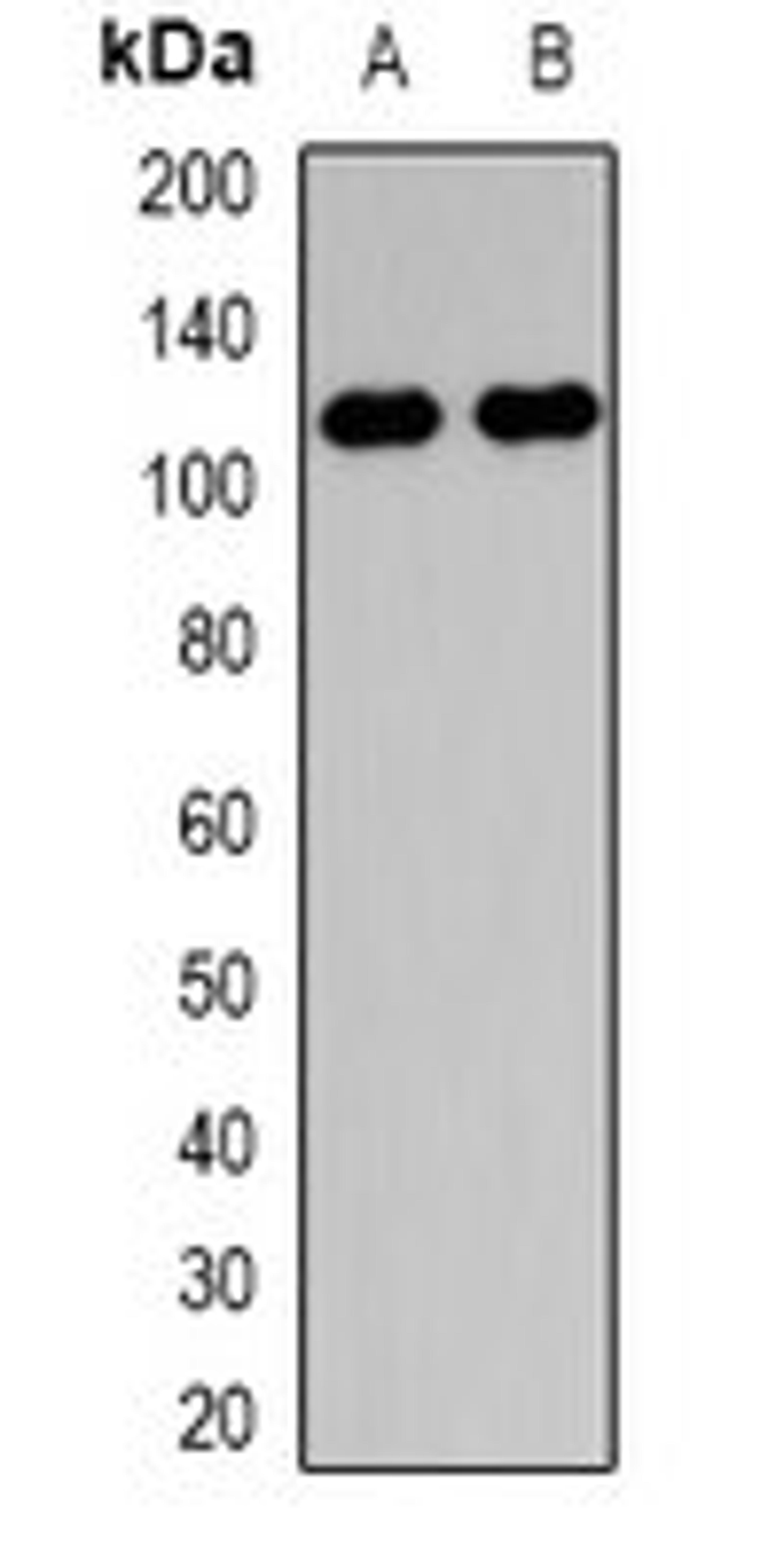 Western blot analysis of HepG2 (Lane1), NIH3T3 (Lane2) whole cell lysates using COL28A1 antibody