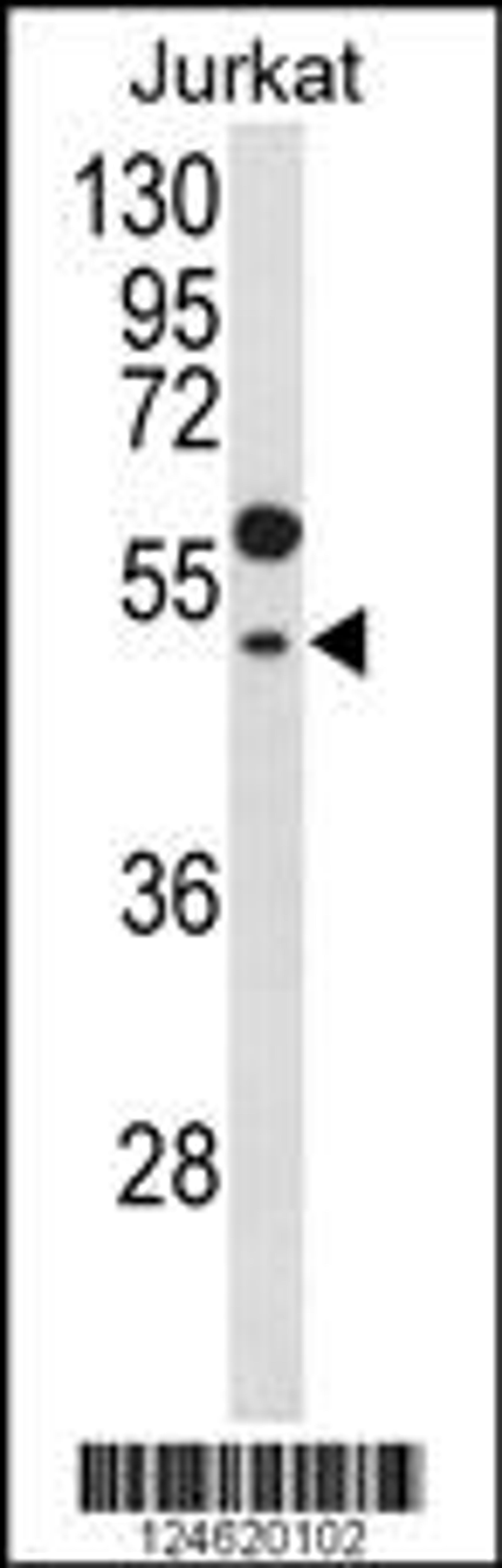 Western blot analysis of GNAT1 Antibody in Jurkat cell line lysates (35ug/lane)