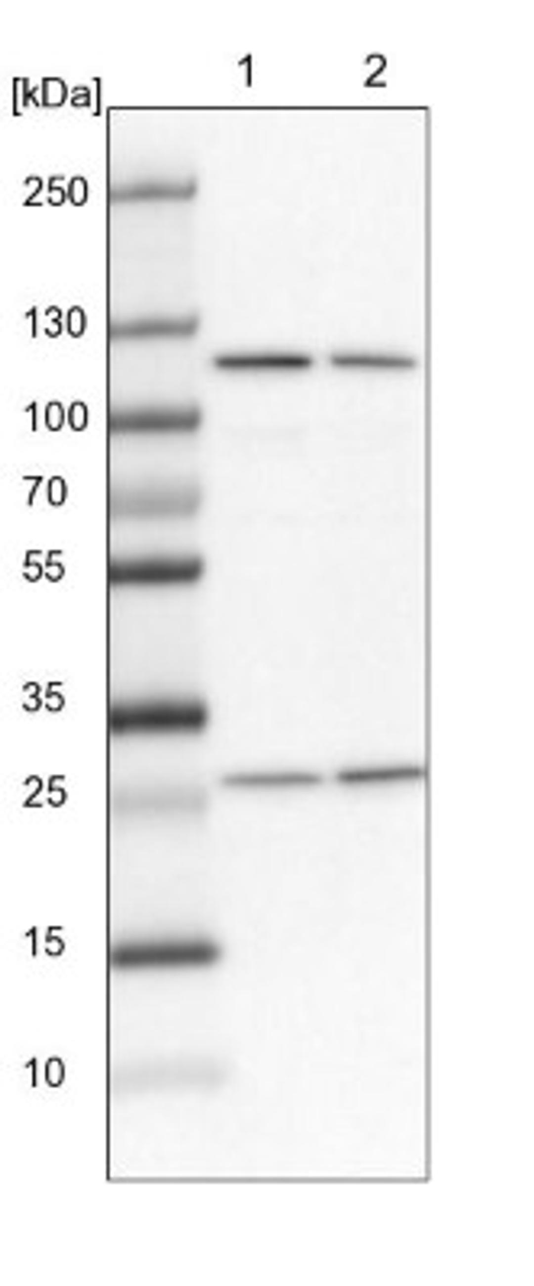 Western Blot: AARSD1 Antibody [NBP1-87414] - Lane 1: NIH-3T3 cell lysate (Mouse embryonic fibroblast cells)<br/>Lane 2: NBT-II cell lysate (Rat Wistar bladder tumour cells)