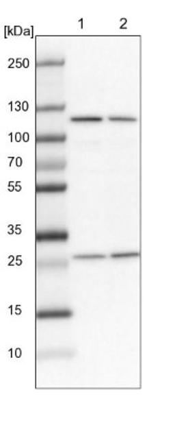 Western Blot: AARSD1 Antibody [NBP1-87414] - Lane 1: NIH-3T3 cell lysate (Mouse embryonic fibroblast cells)<br/>Lane 2: NBT-II cell lysate (Rat Wistar bladder tumour cells)