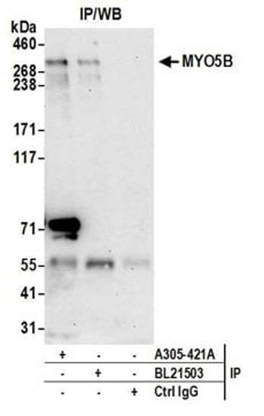 Detection of human MYO5B by western blot of immunoprecipitates.