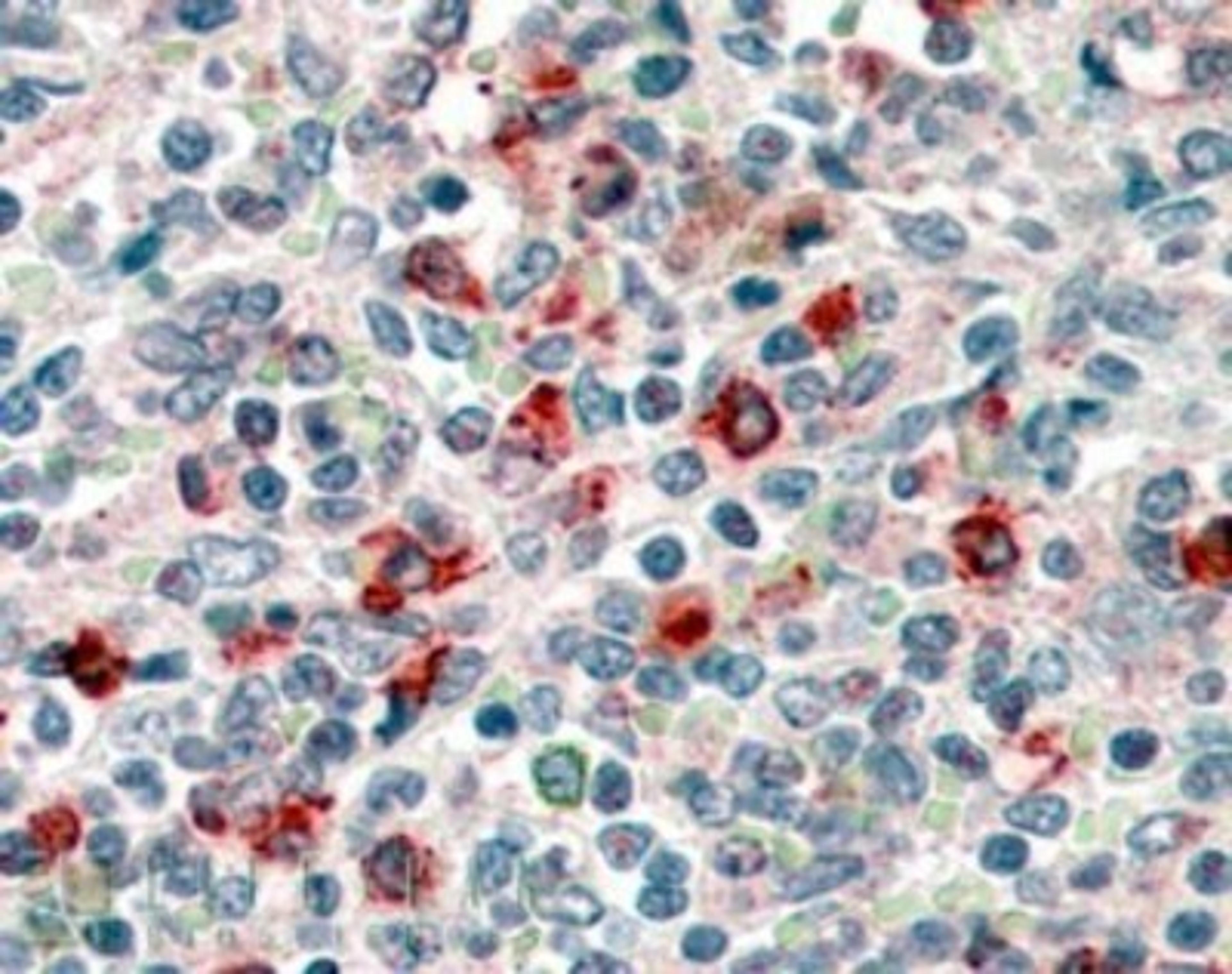 Immunohistochemistry-Paraffin: CD14 Antibody [NB100-2807] - Staining of Human Spleen. Steamed antigen retrieval with citrate buffer pH 6, AP-staining. (4 ug/ml)