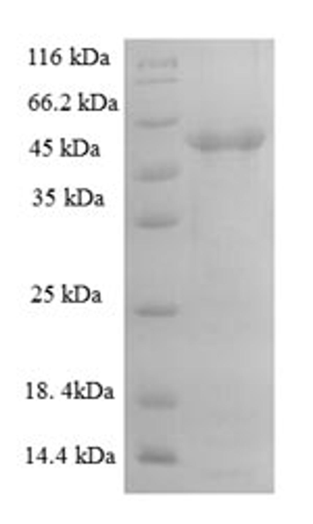 (Tris-Glycine gel) Discontinuous SDS-PAGE (reduced) with 5% enrichment gel and 15% separation gel.