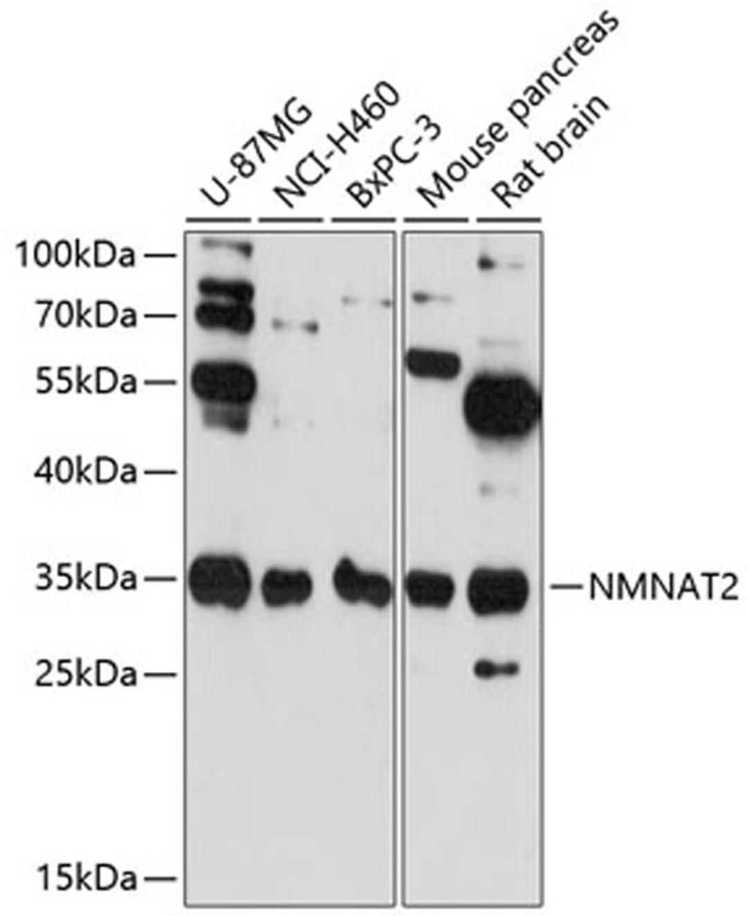 Western blot - NMNAT2 antibody (A13833)