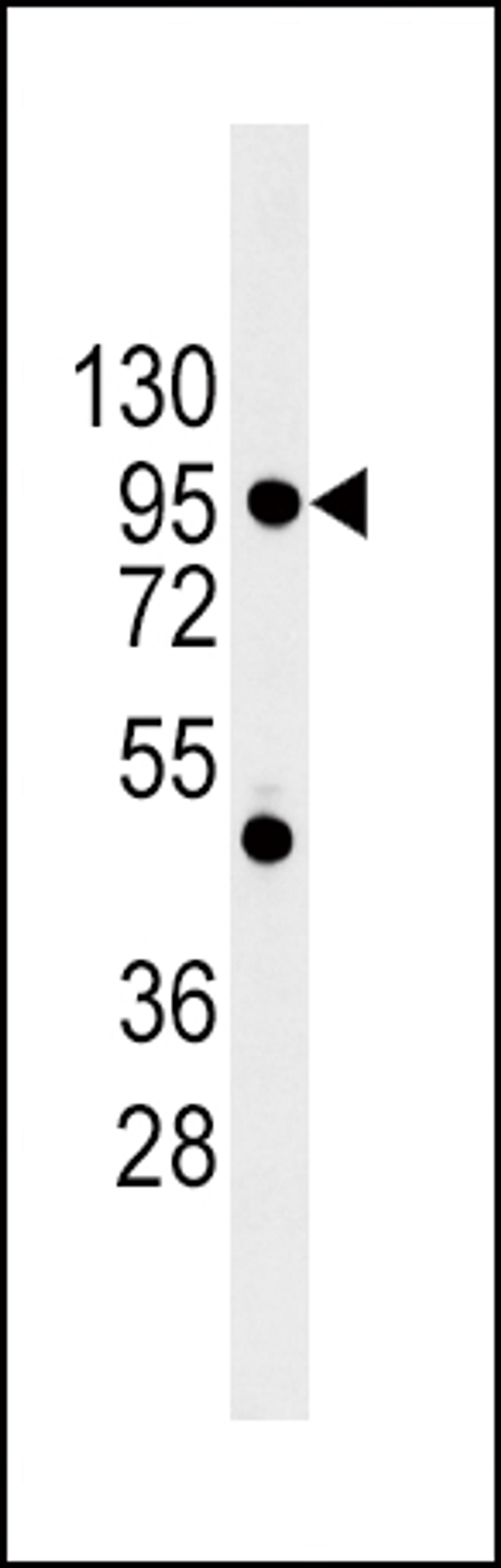 Western blot analysis of CDH1 Antibody in 293 cell line lysates (35ug/lane)