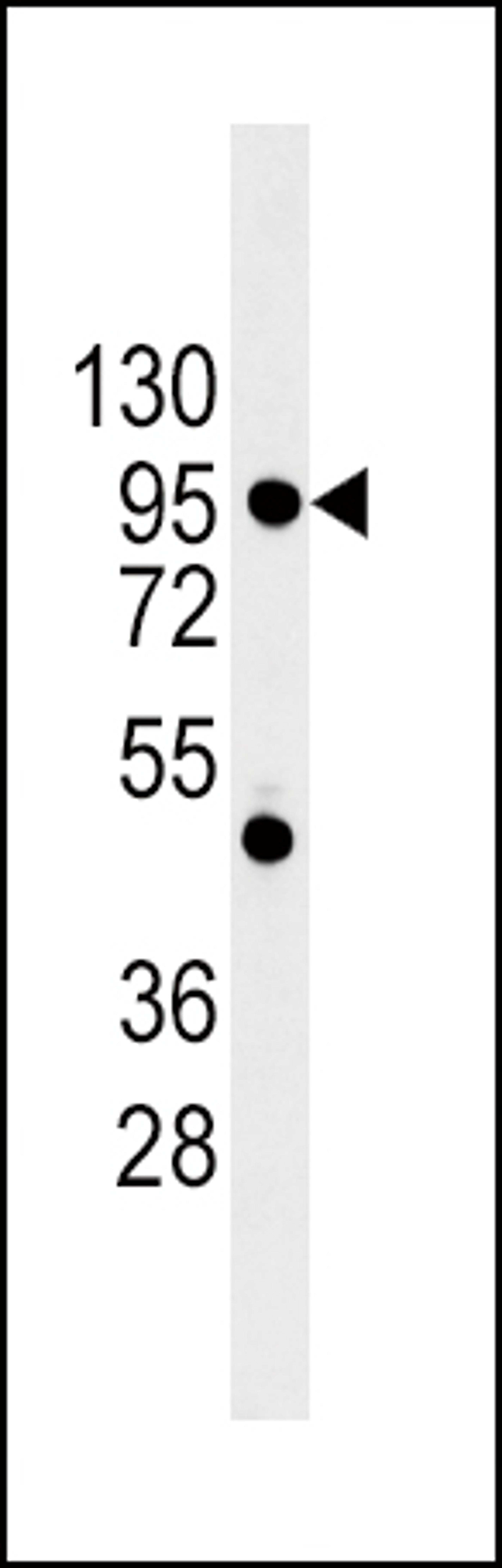 Western blot analysis of CDH1 Antibody in 293 cell line lysates (35ug/lane)