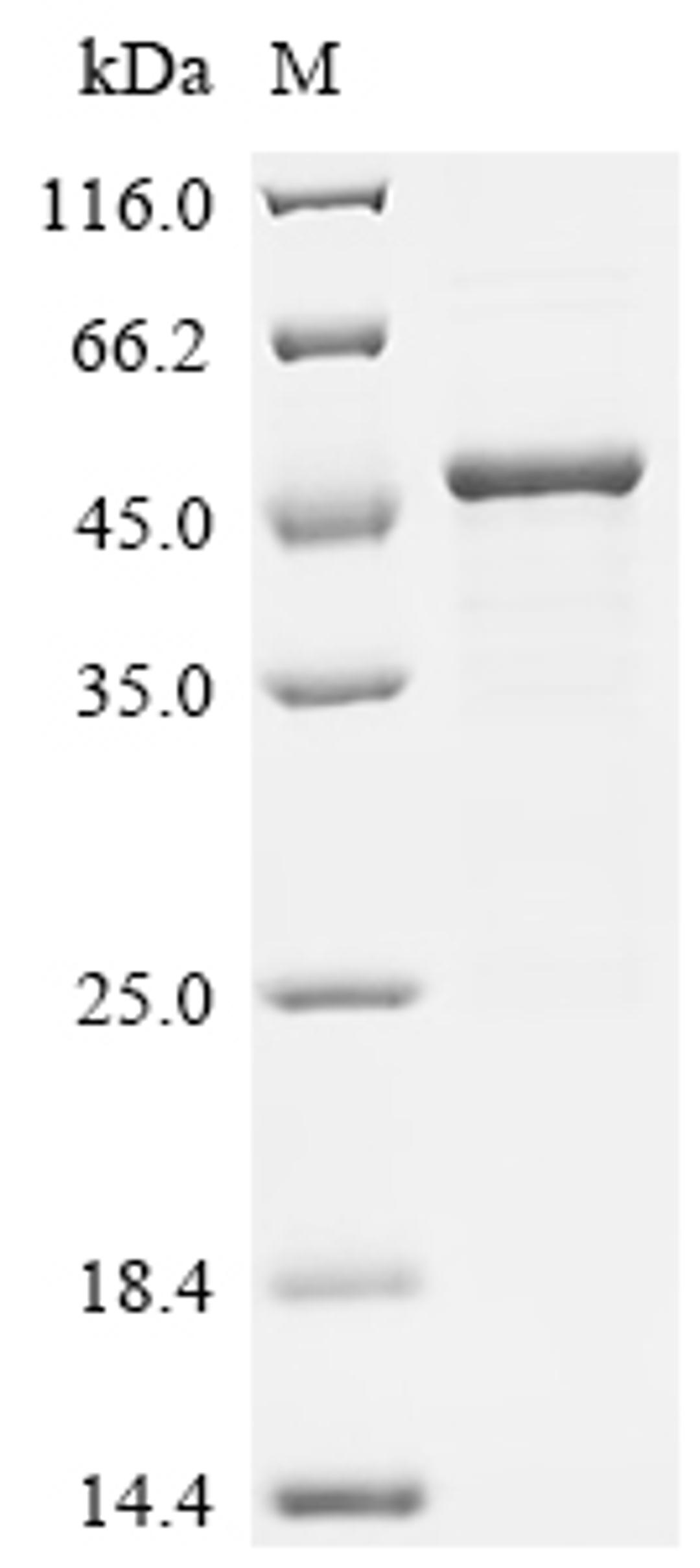 (Tris-Glycine gel) Discontinuous SDS-PAGE (reduced) with 5% enrichment gel and 15% separation gel.