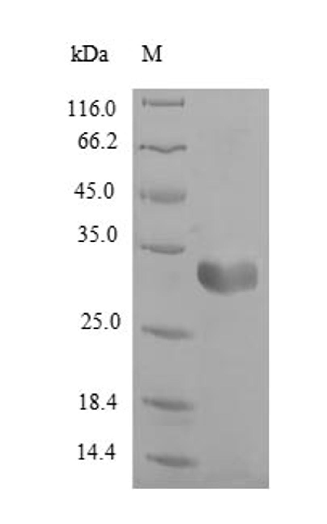 (Tris-Glycine gel) Discontinuous SDS-PAGE (reduced) with 5% enrichment gel and 15% separation gel.