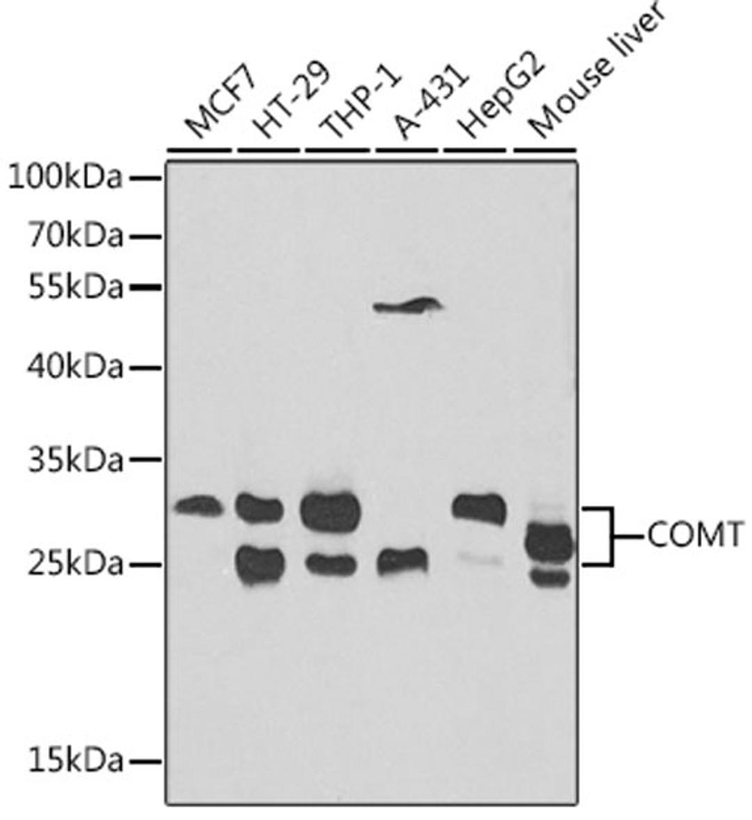 Western blot - COMT antibody (A1294)