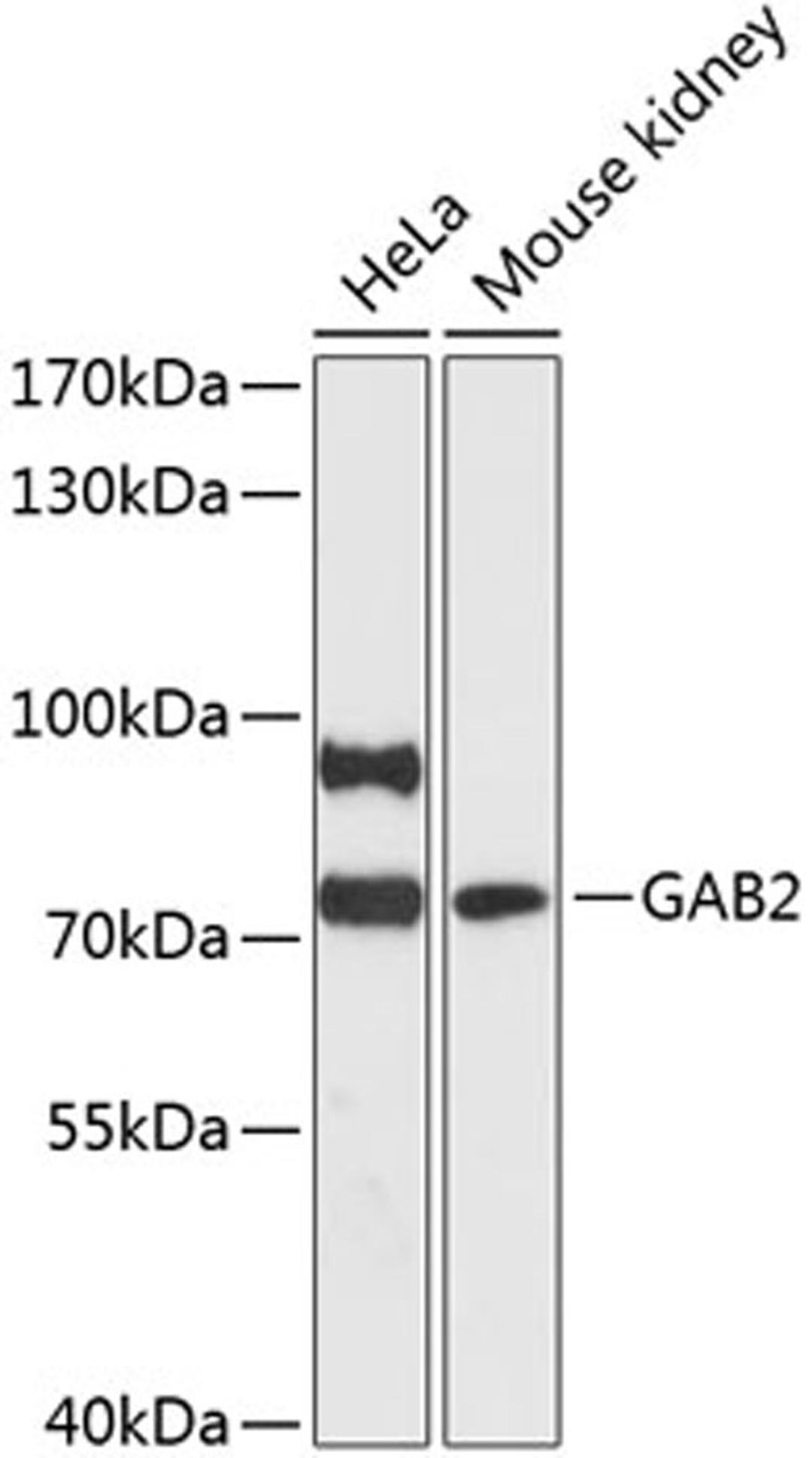 Western blot - GAB2 antibody (A13066)