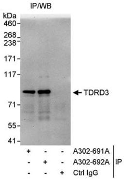 Detection of human TDRD3 by western blot of immunoprecipitates.