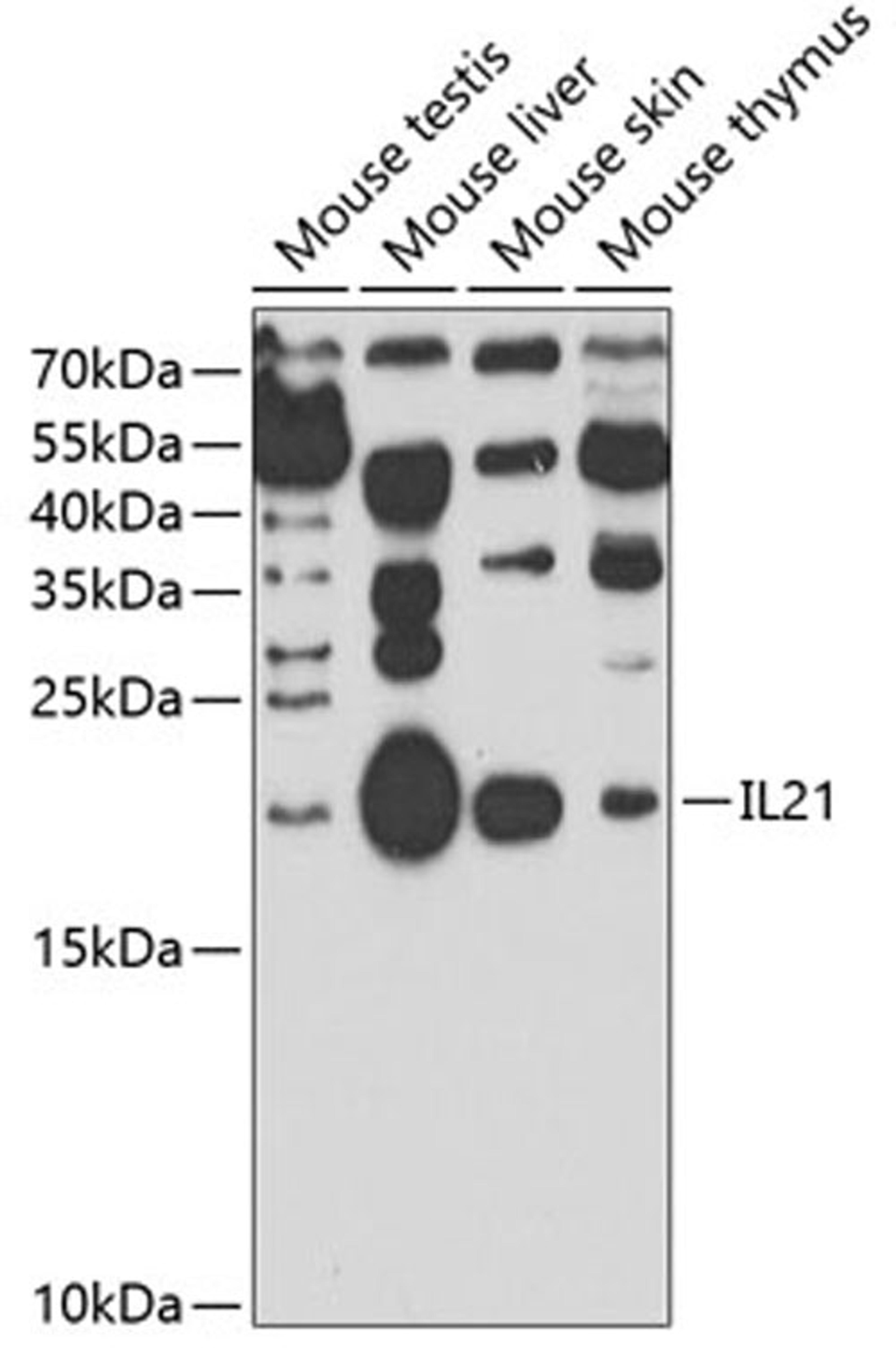 Western blot - IL21 antibody (A7235)