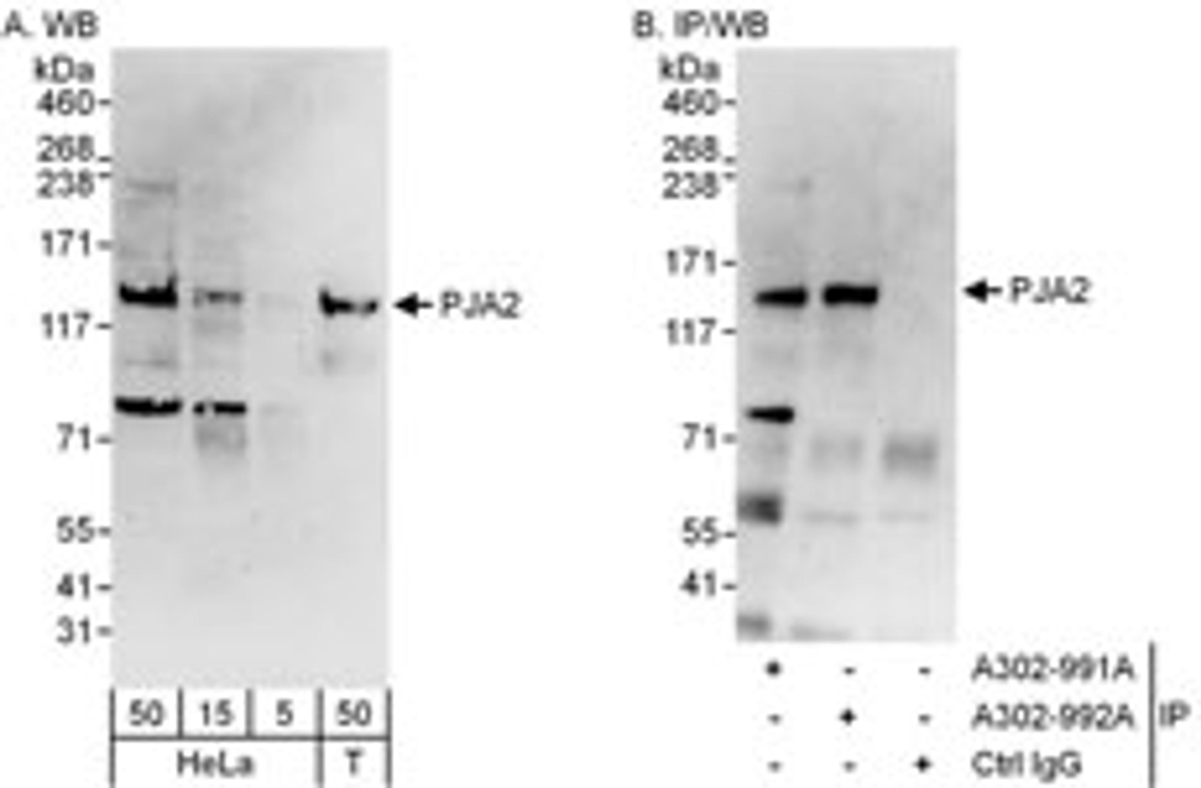 Detection of human PJA2 by western blot and immunoprecipitation.