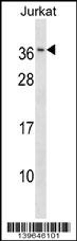 Western blot analysis in Jurkat cell line lysates (35ug/lane).