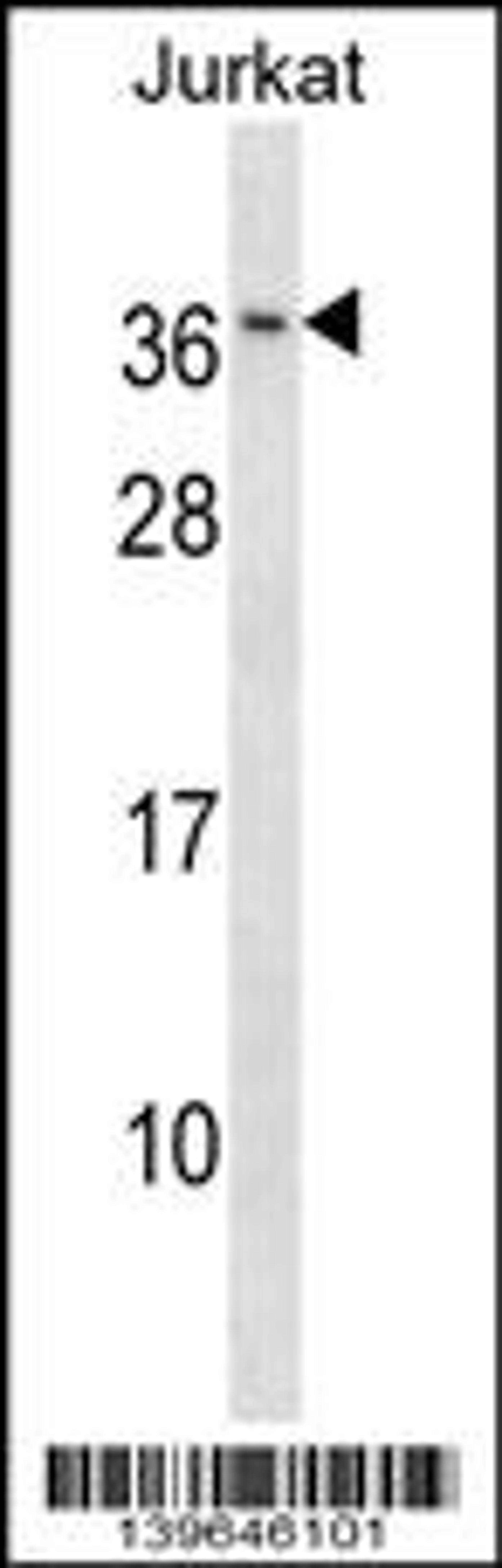 Western blot analysis in Jurkat cell line lysates (35ug/lane).