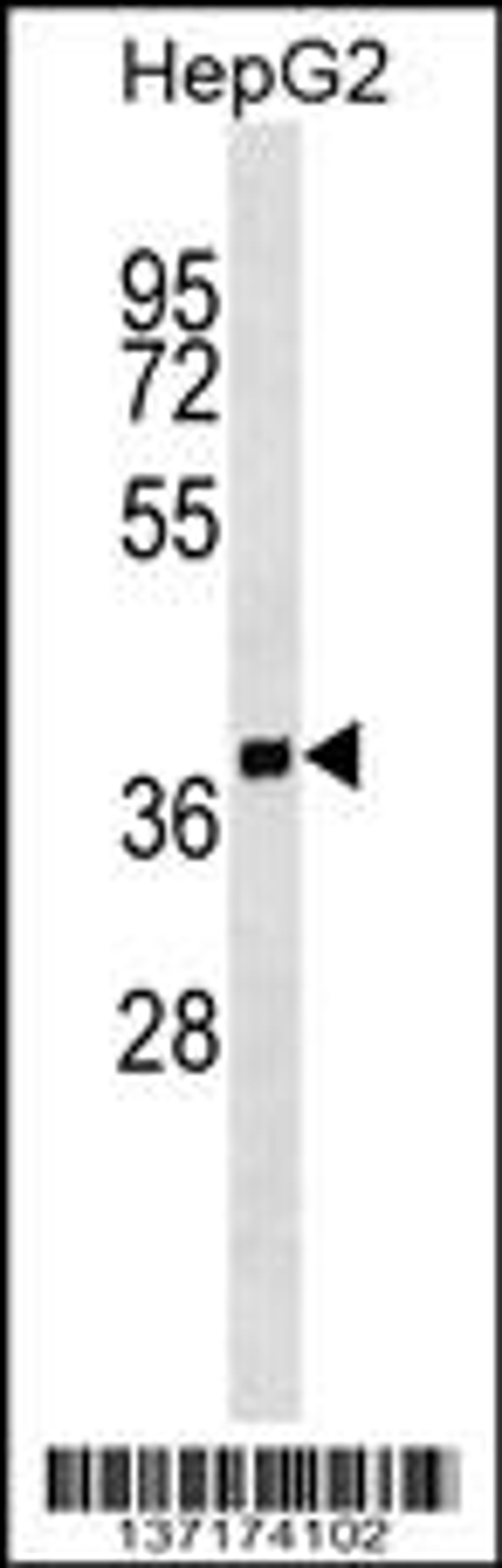 Western blot analysis in HepG2 cell line lysates (35ug/lane).